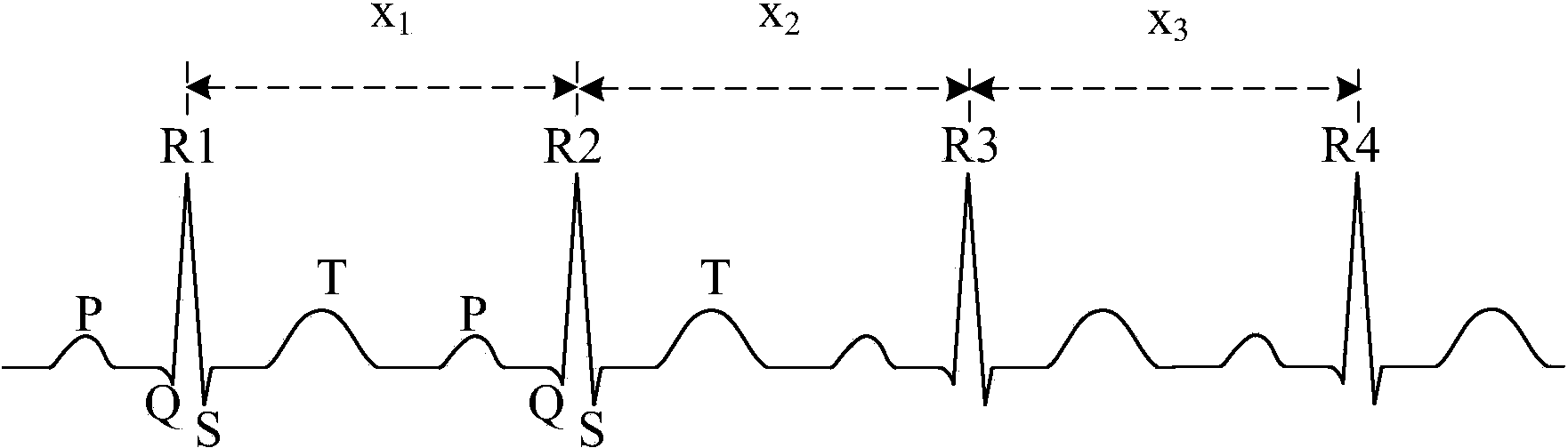 Method and device for heart rate analysis based on electrocardiogram