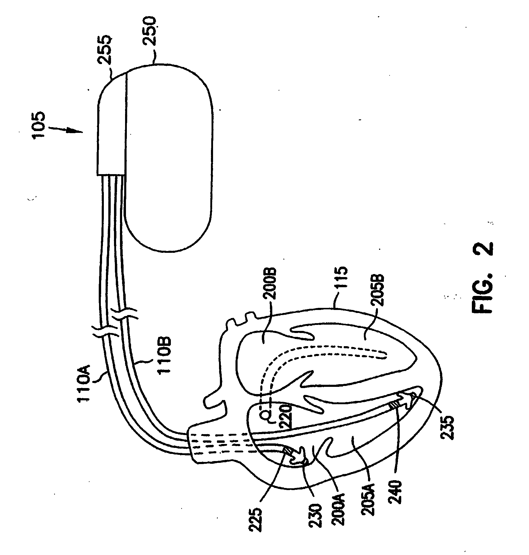 System and method for recovery from memory errors in a medical device