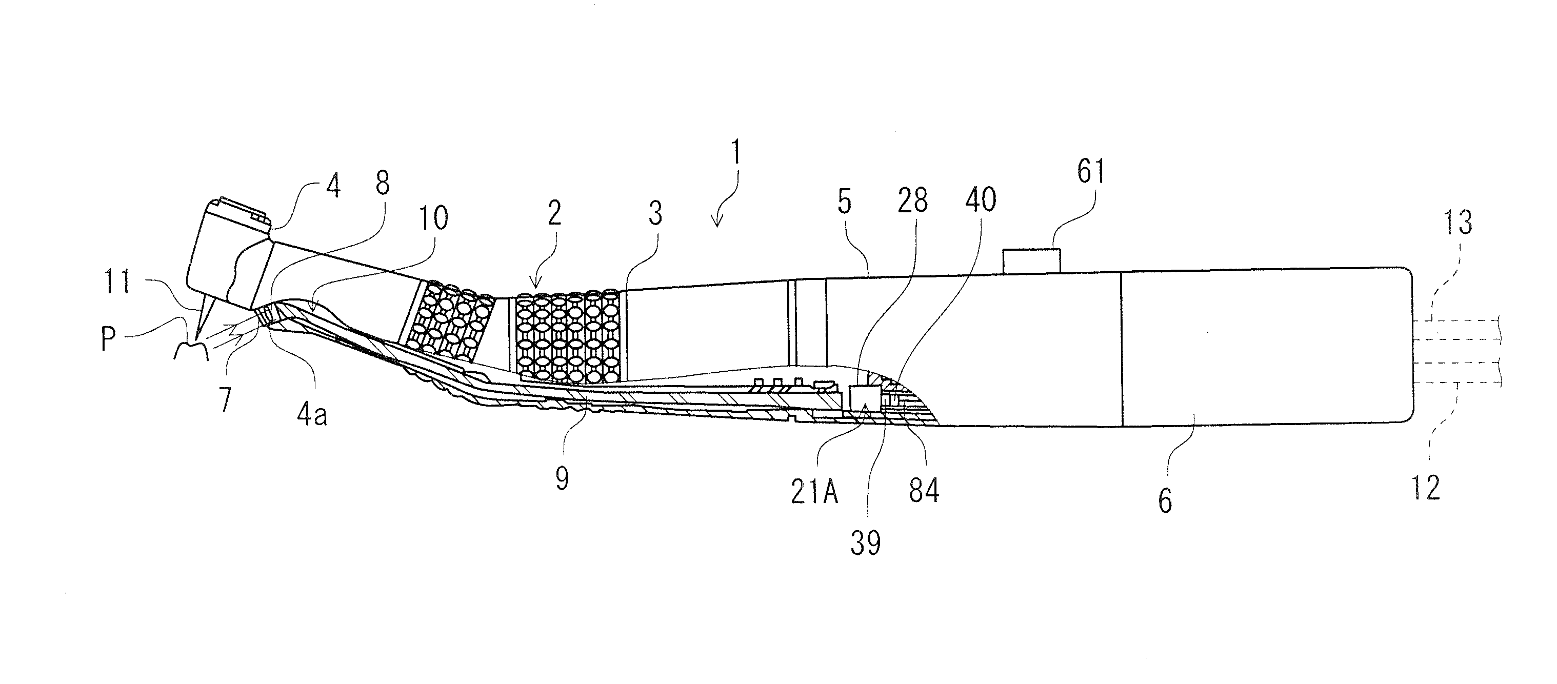 Dental treatment implement with anomaly site detection function