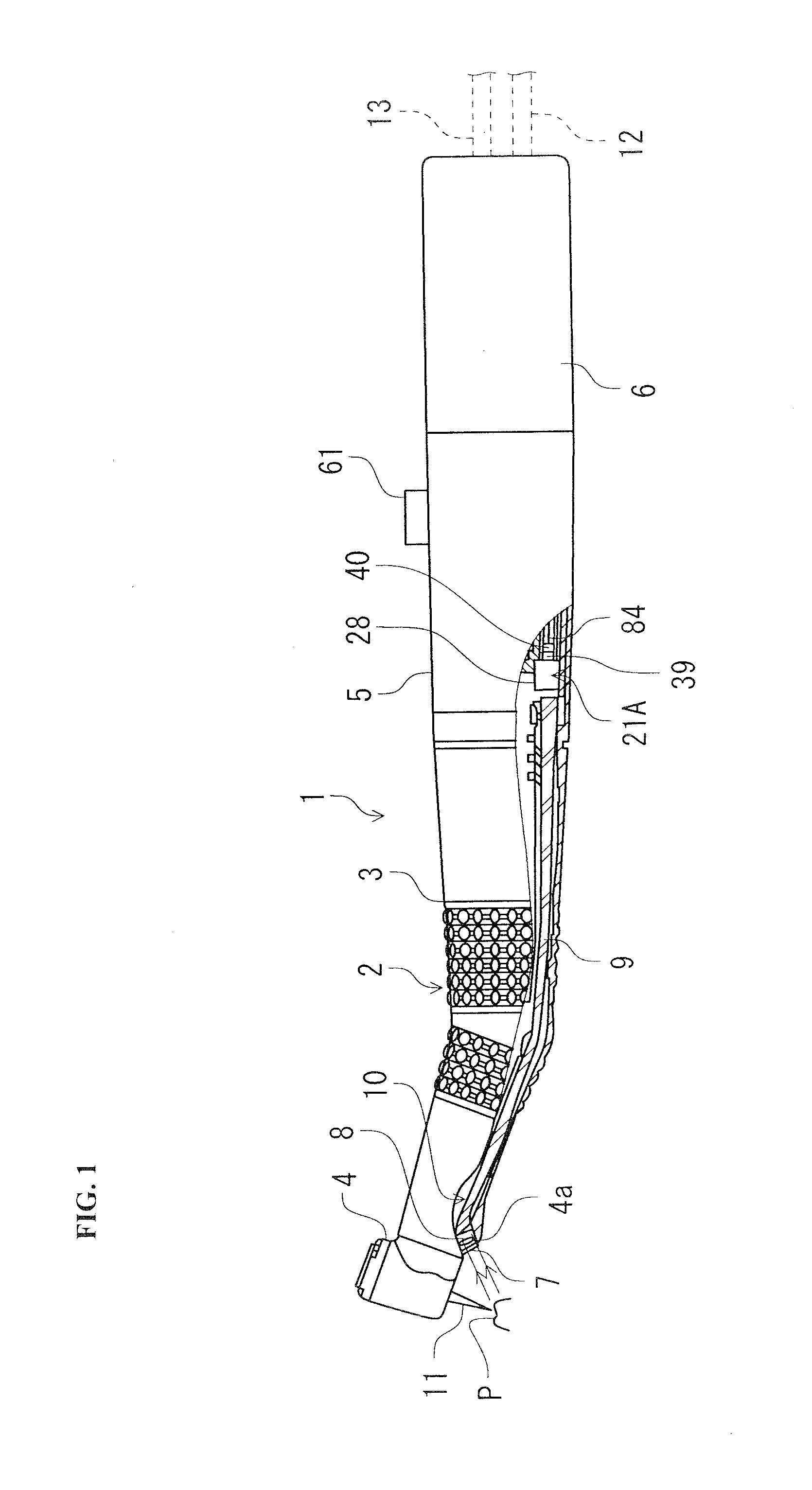 Dental treatment implement with anomaly site detection function