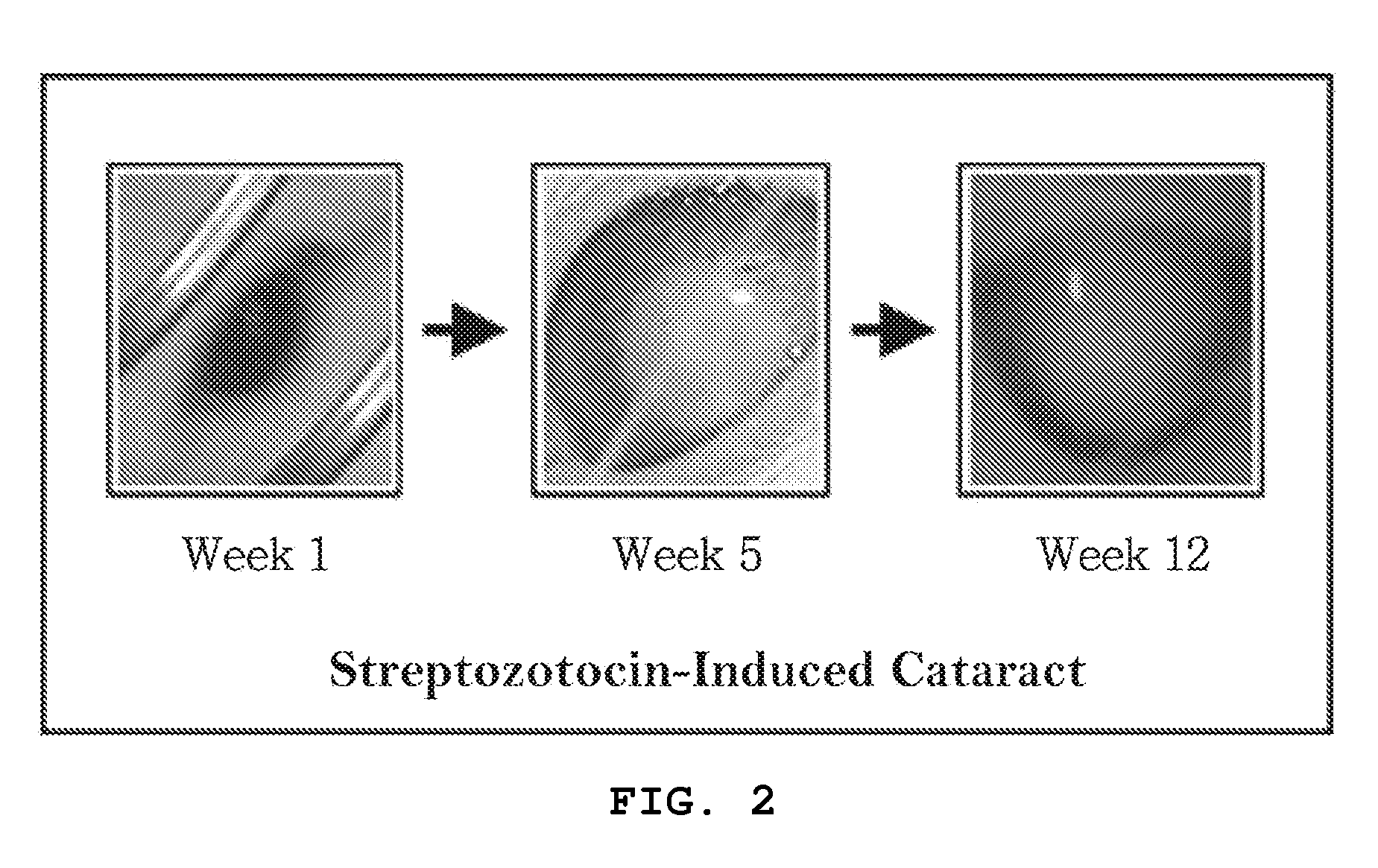 Vision-protecting composition with prophylactic and therapeutic activity against diabetes or diabetic complications