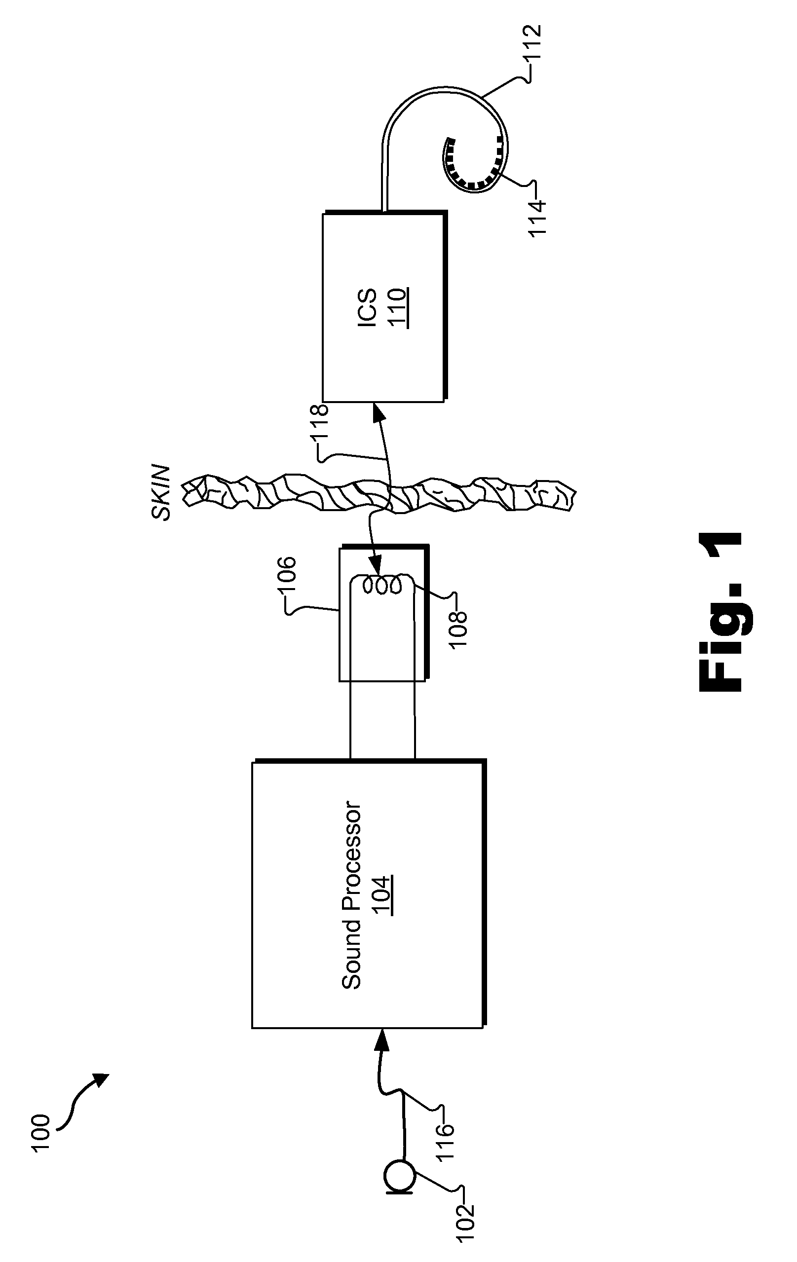 Methods and Systems for Importing Data into a Database Associated with a Cochlear Implant Fitting Software Product