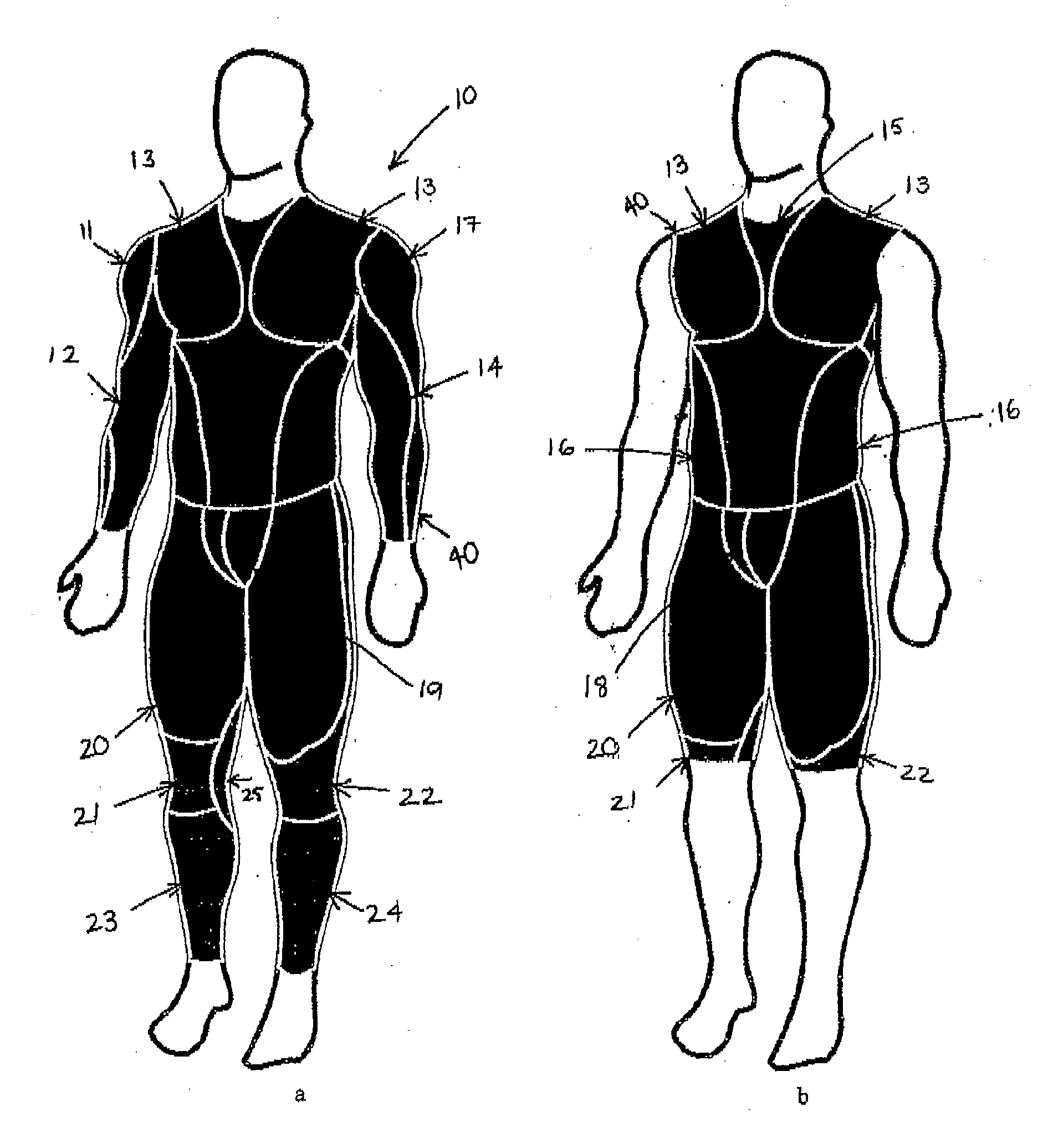 Compression garment or method of manufacture