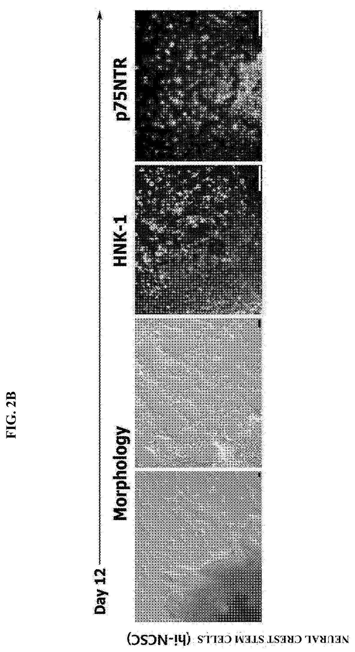 Method of differentiation of human induced pluripotent stem cell to dermal papilla precursor cell and use thereof