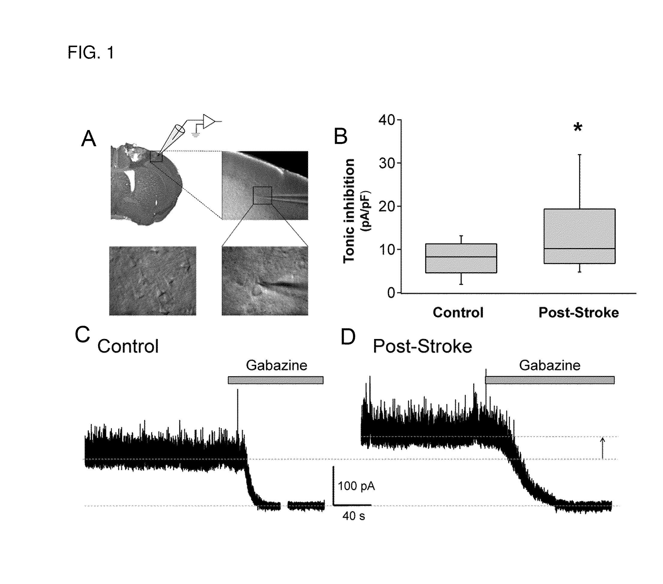 Methods and compositions for treating a subject for central nervous system (CNS) injury