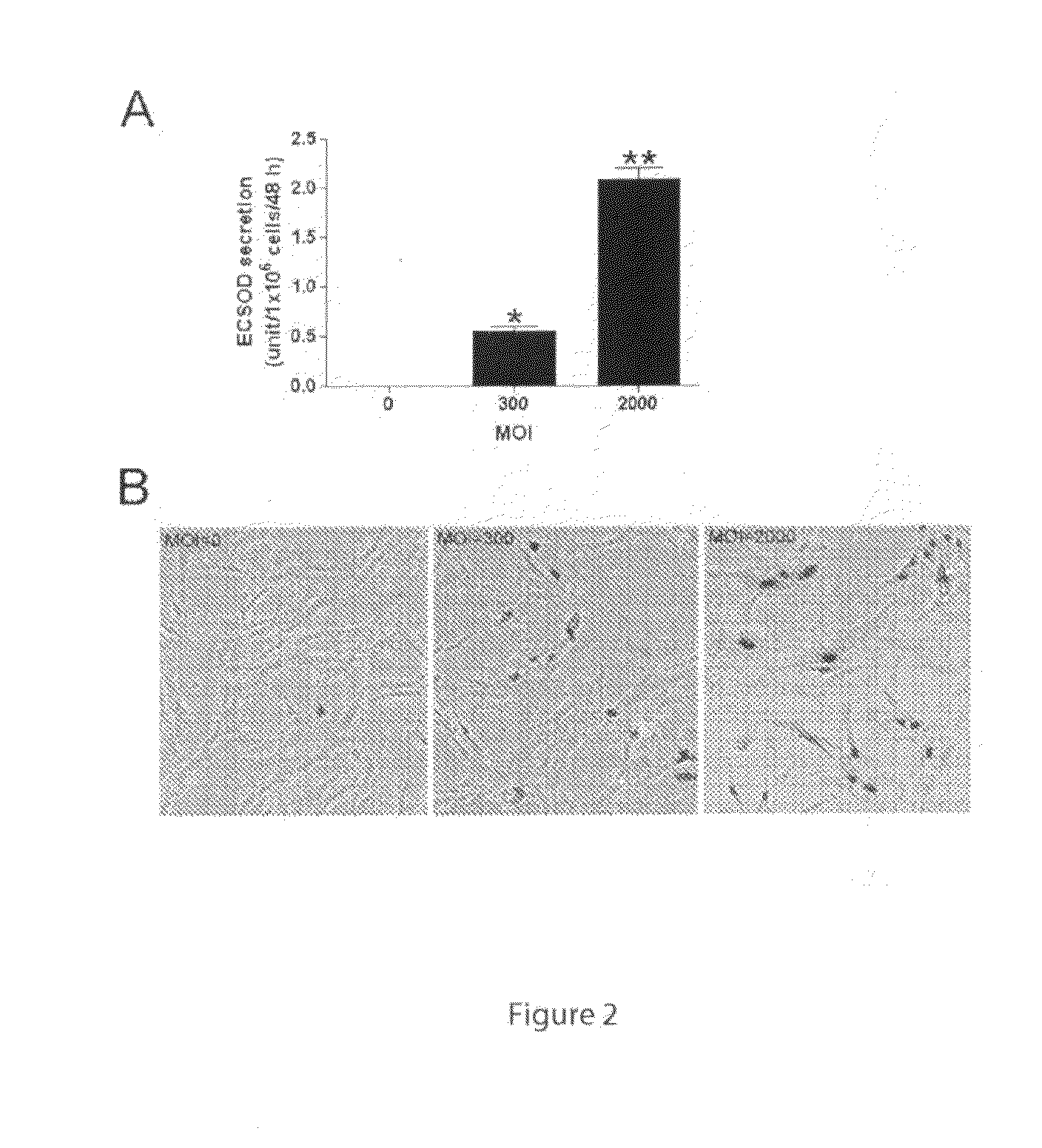 Method for treating and preventing radiation damage using genetically modified mesenchymal stem cells