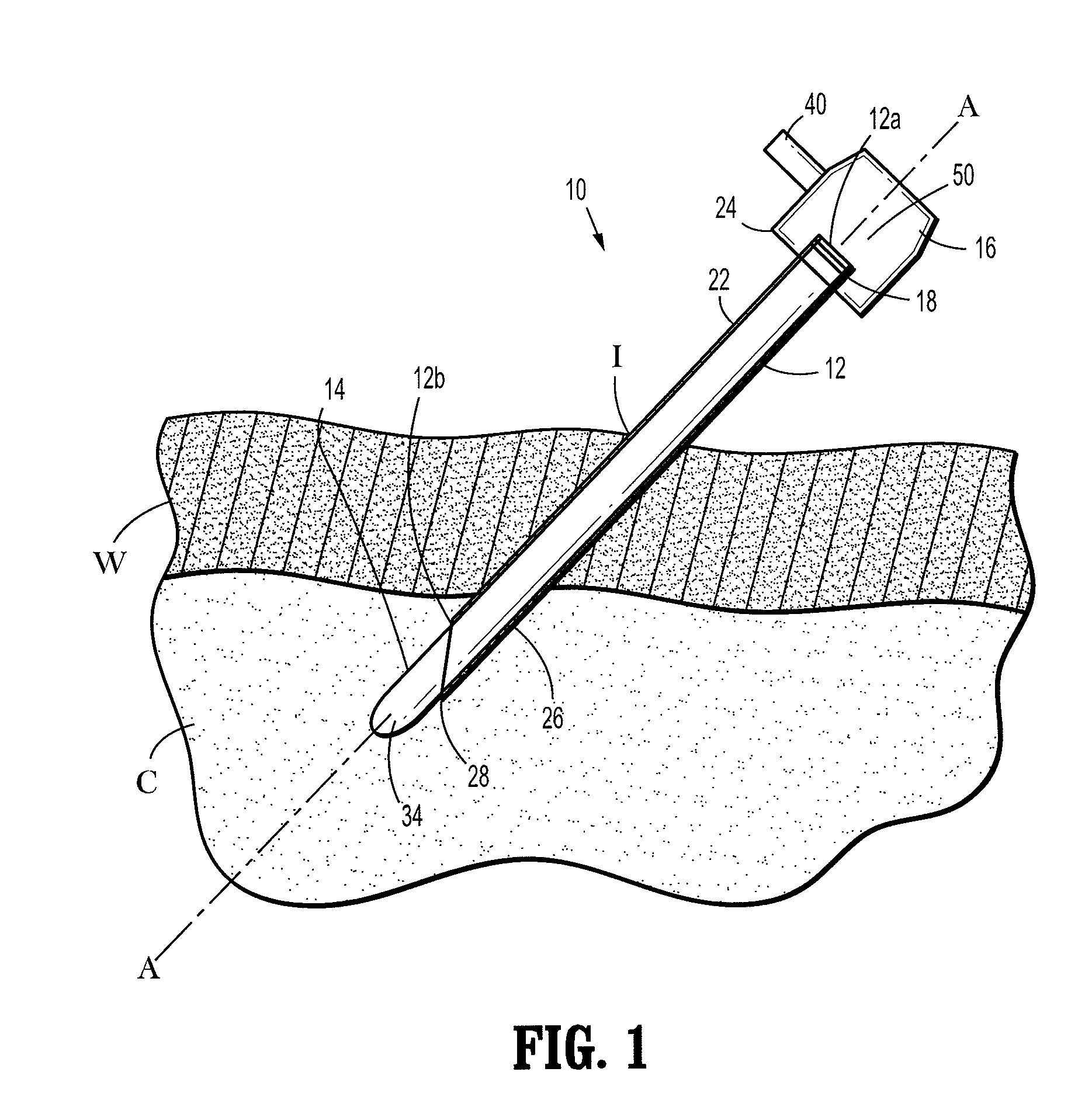 Bendable veress needle assembly