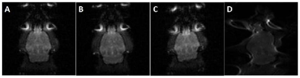 Image distortion correction method based on single-scan hybrid spatio-temporal coding magnetic resonance imaging