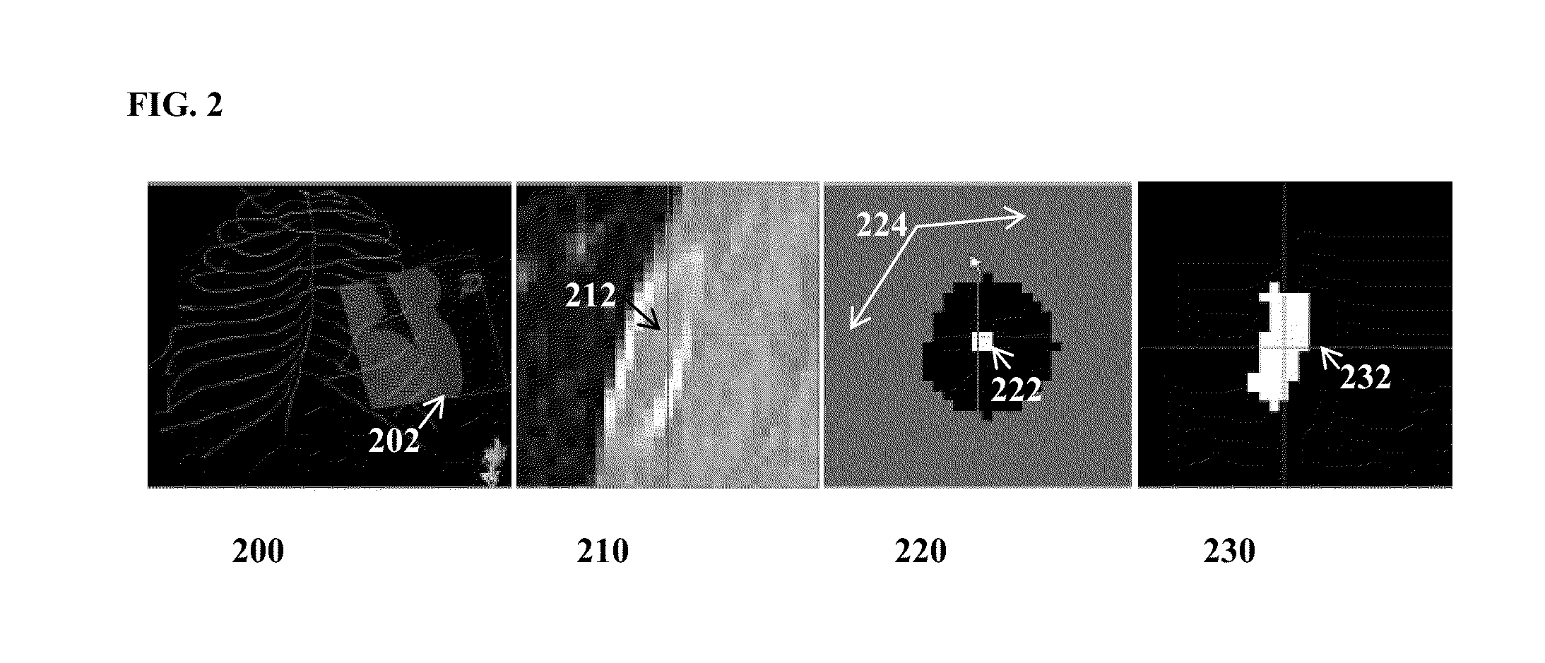 System and Method for Data Driven Editing of Rib Unfolding