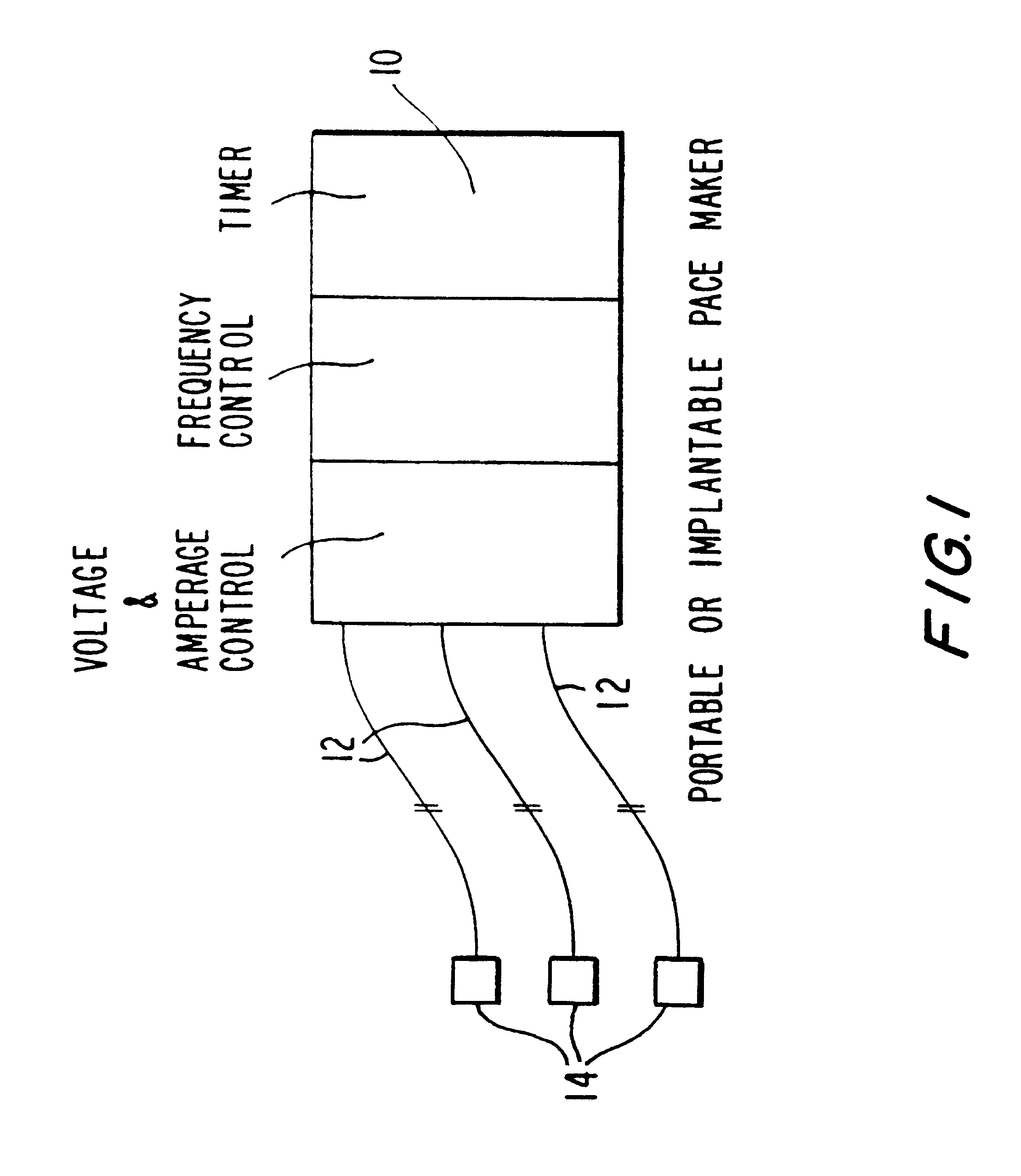Electrical system for weight loss and laparoscopic implanation thereof
