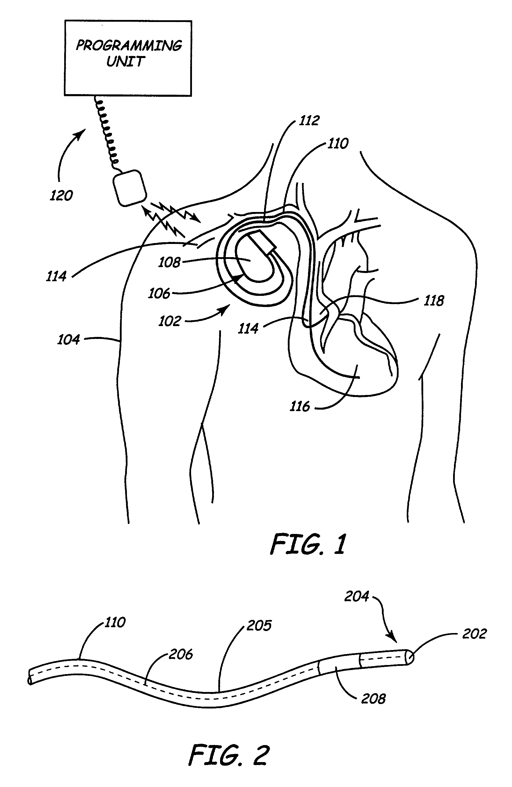 Method and apparatus for shunting induced currents in an electrical lead