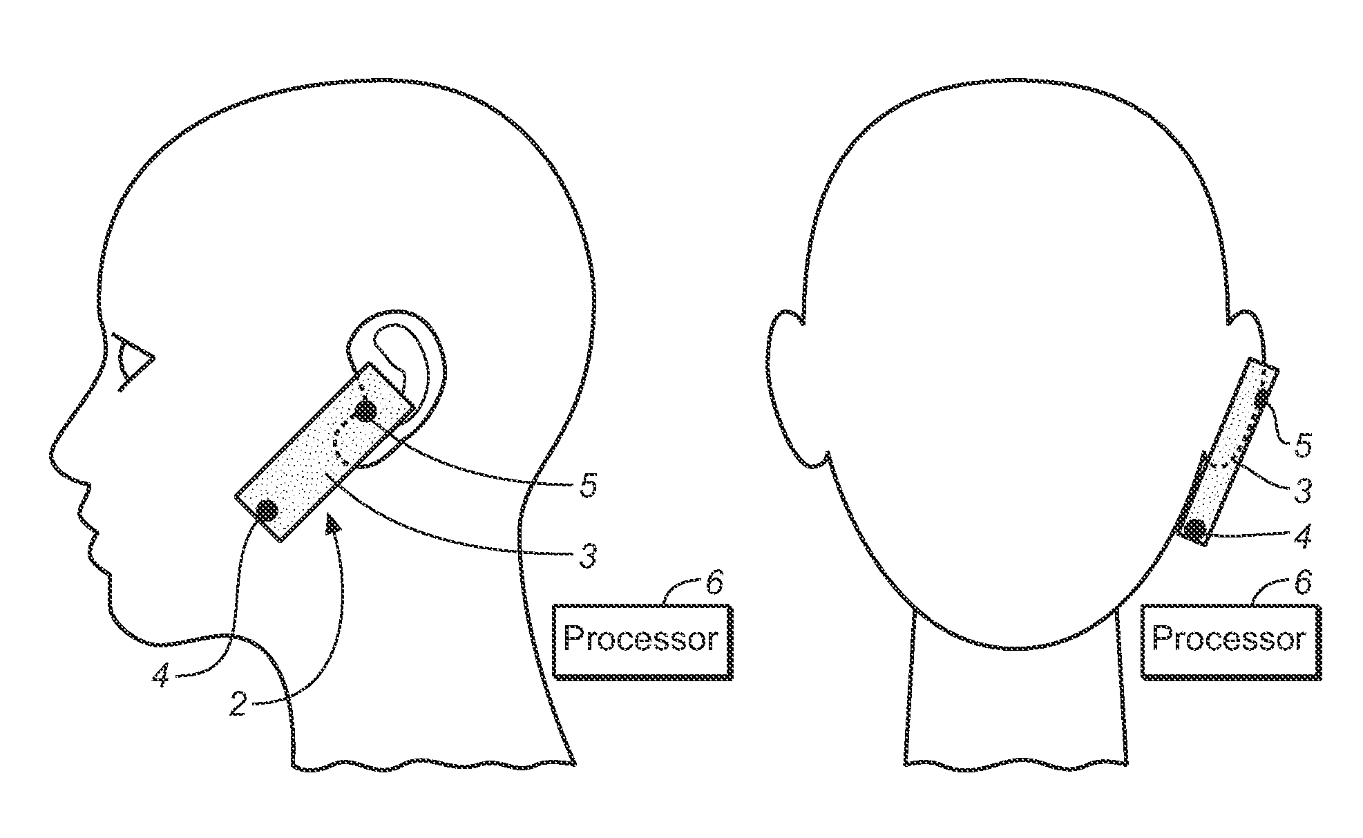 Method and System for Touch Gesture Detection in Response to Microphone Output