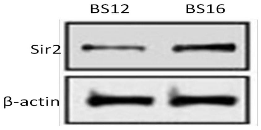 A kind of Bacillus subtilis with cephalosporin resistance and high expression sir2 protein and application thereof