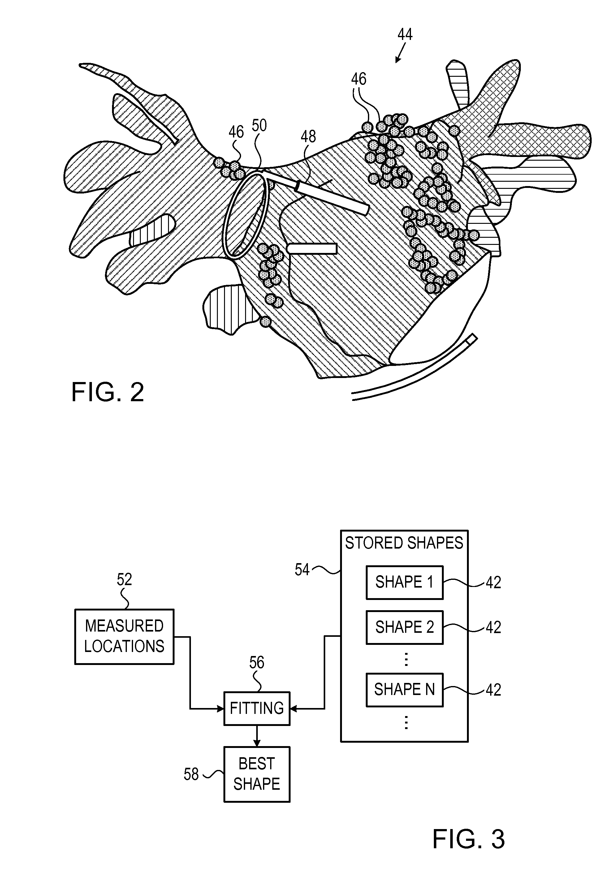 Model based reconstruction of the heart from sparse samples