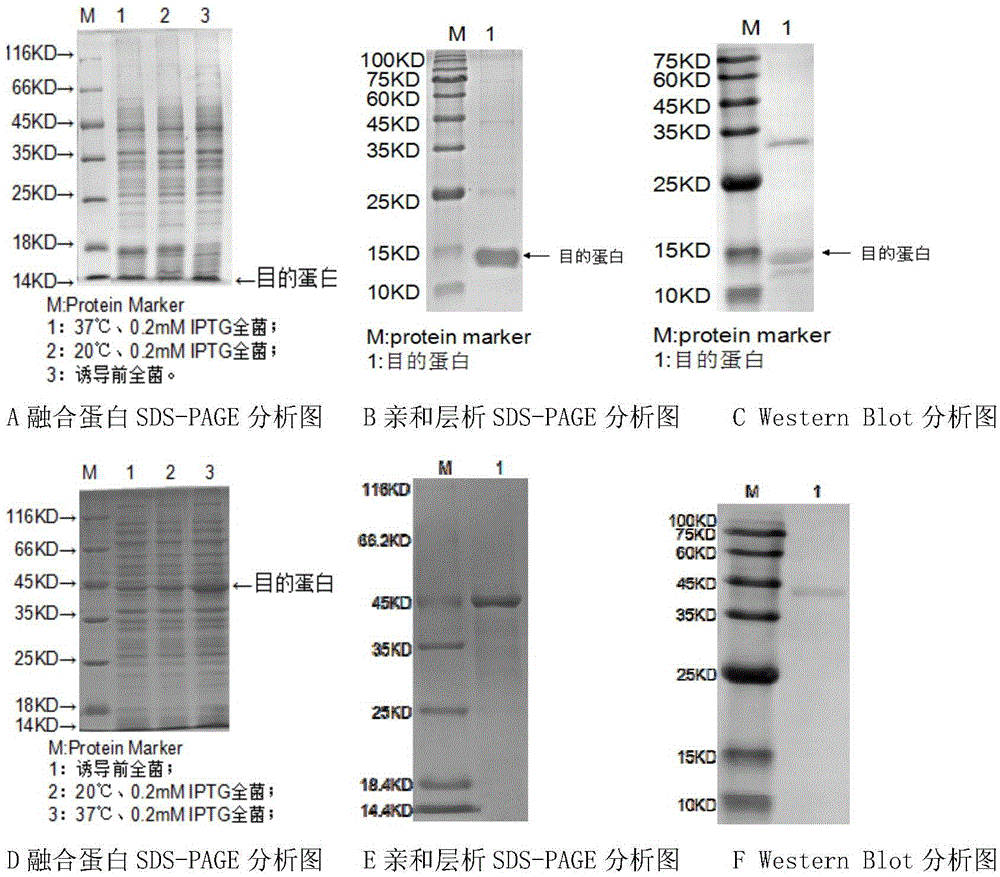 Acinetobacter baumannii and subunit protein combined vaccine and preparation method thereof