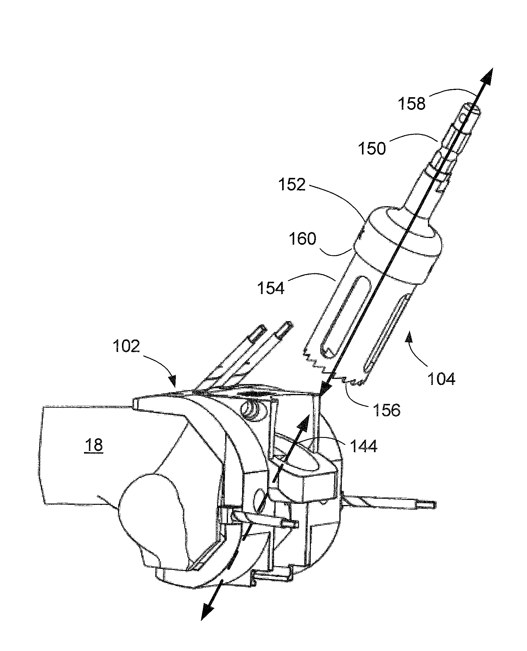 Methods and apparatus for preparing an intercondylar area of a distal femur