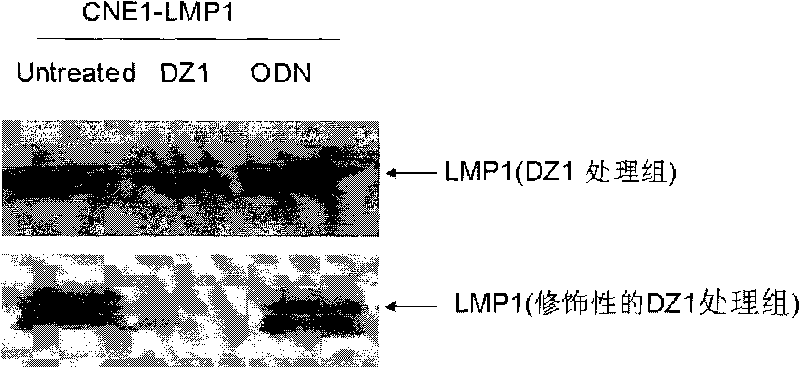 LMP1targeted oligonucleotide and application thereof serving as radiotherapeutic sensitizer