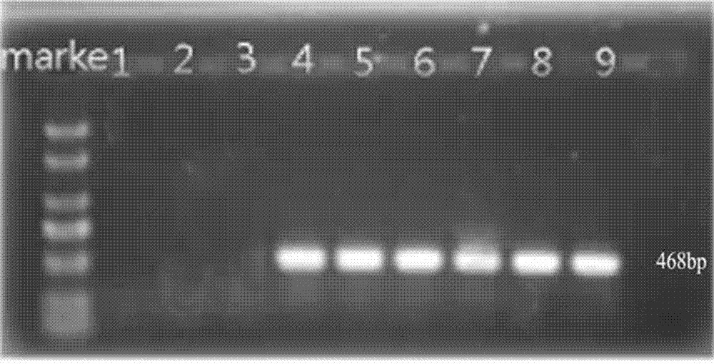 Method for rapidly detecting pathogenic anthracnose of dracaena sanderiana and application thereof