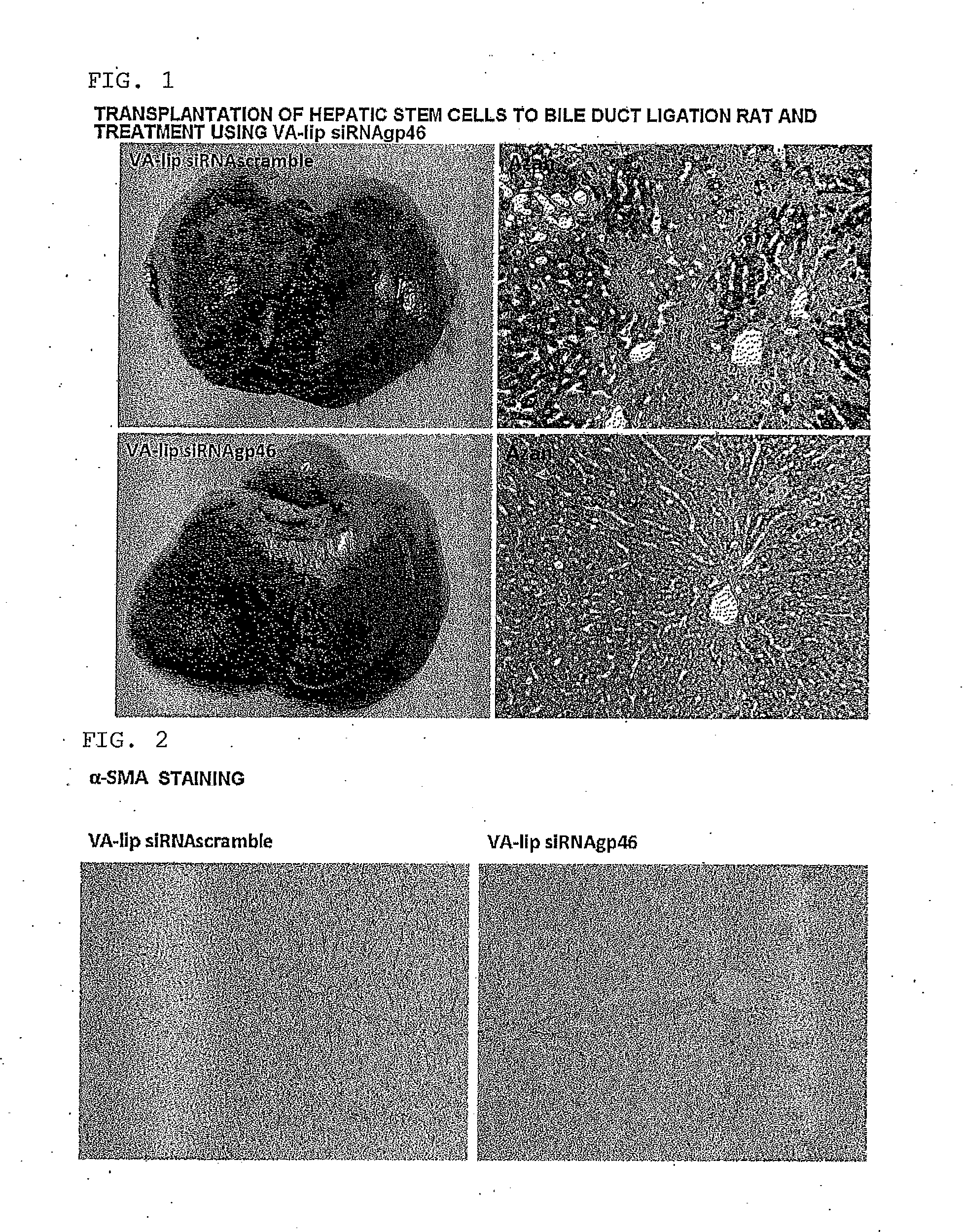 Composition for regenerating normal tissue from fibrotic tissue