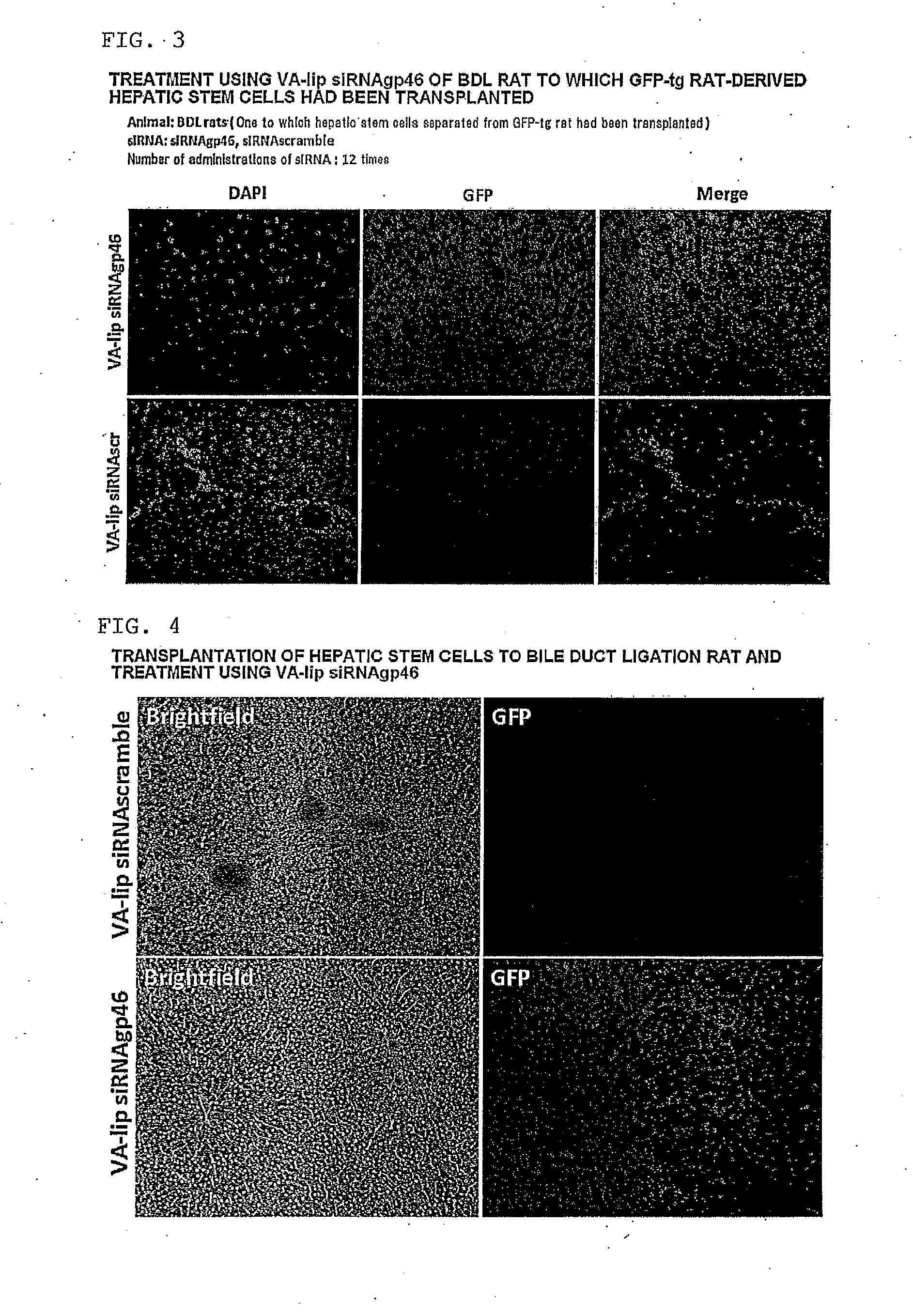 Composition for regenerating normal tissue from fibrotic tissue