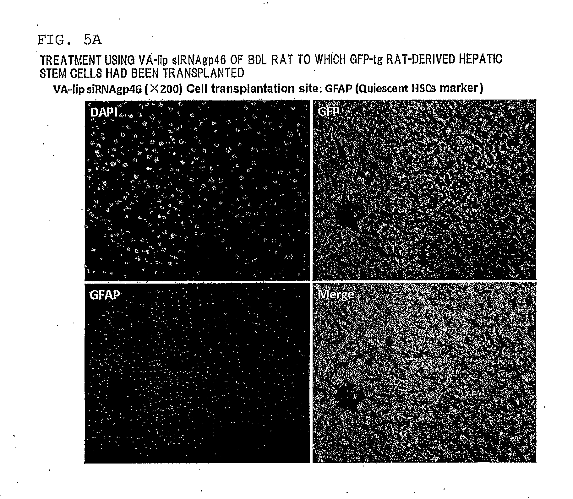 Composition for regenerating normal tissue from fibrotic tissue