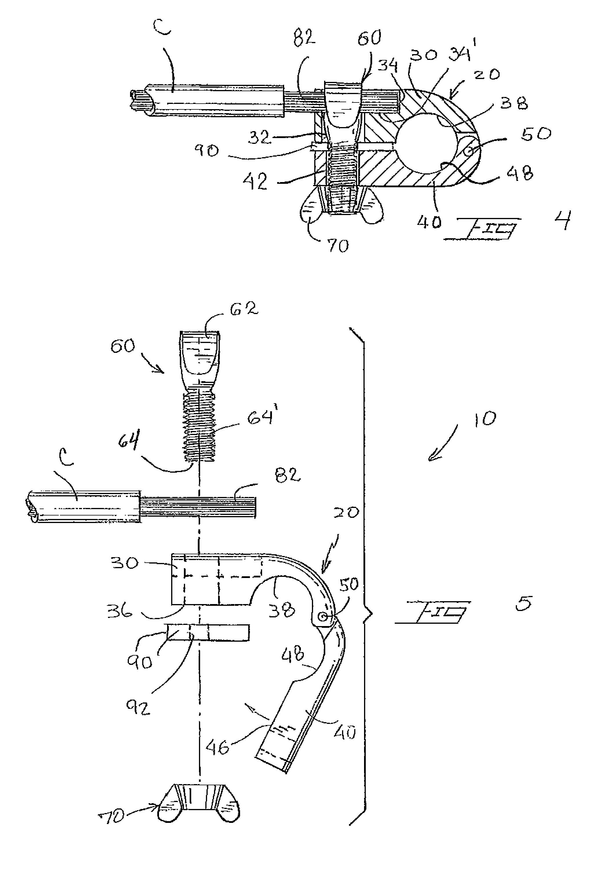 Battery terminal