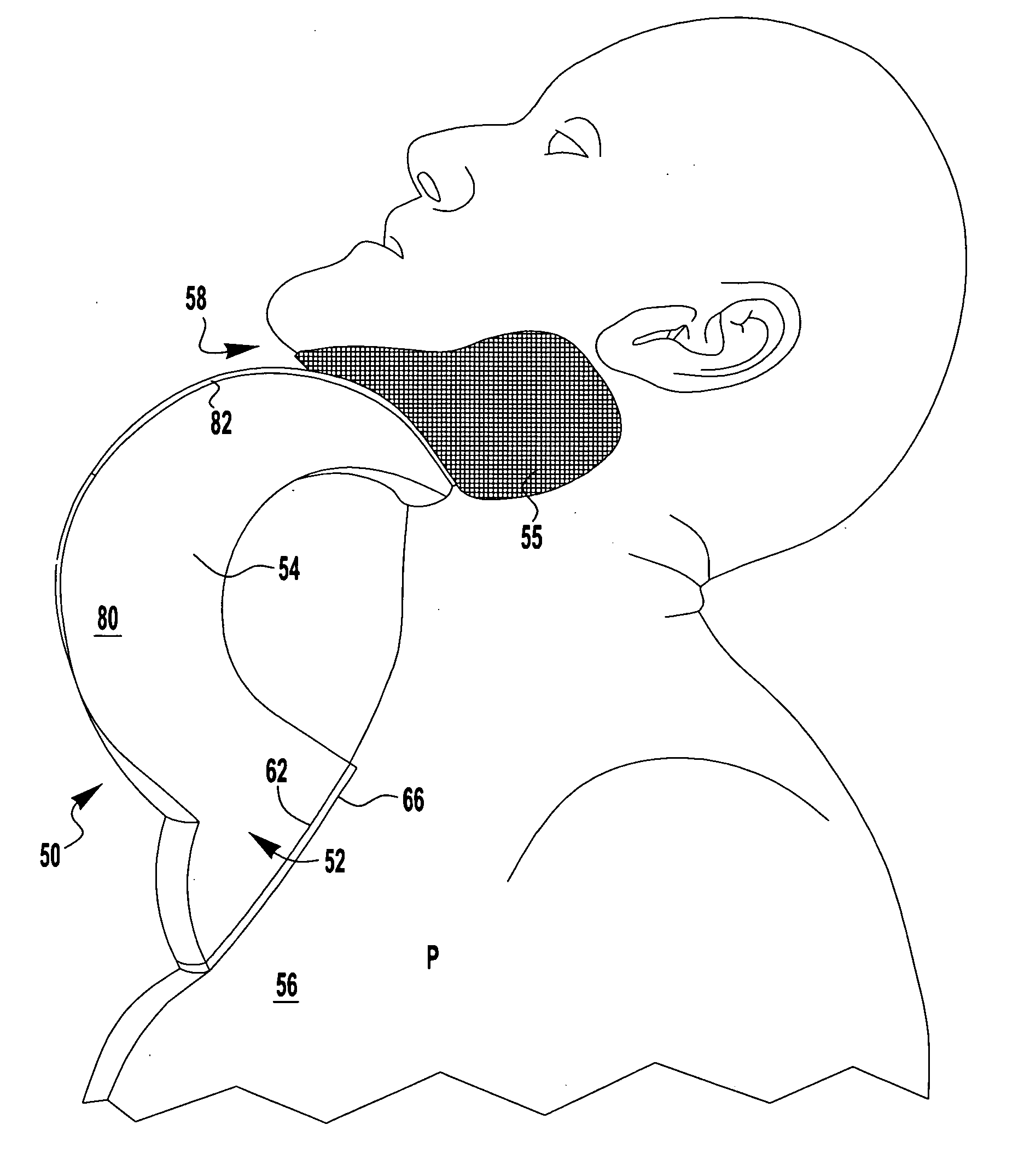Therapeutic/diagnostic external airway position support (EAPS) device and method