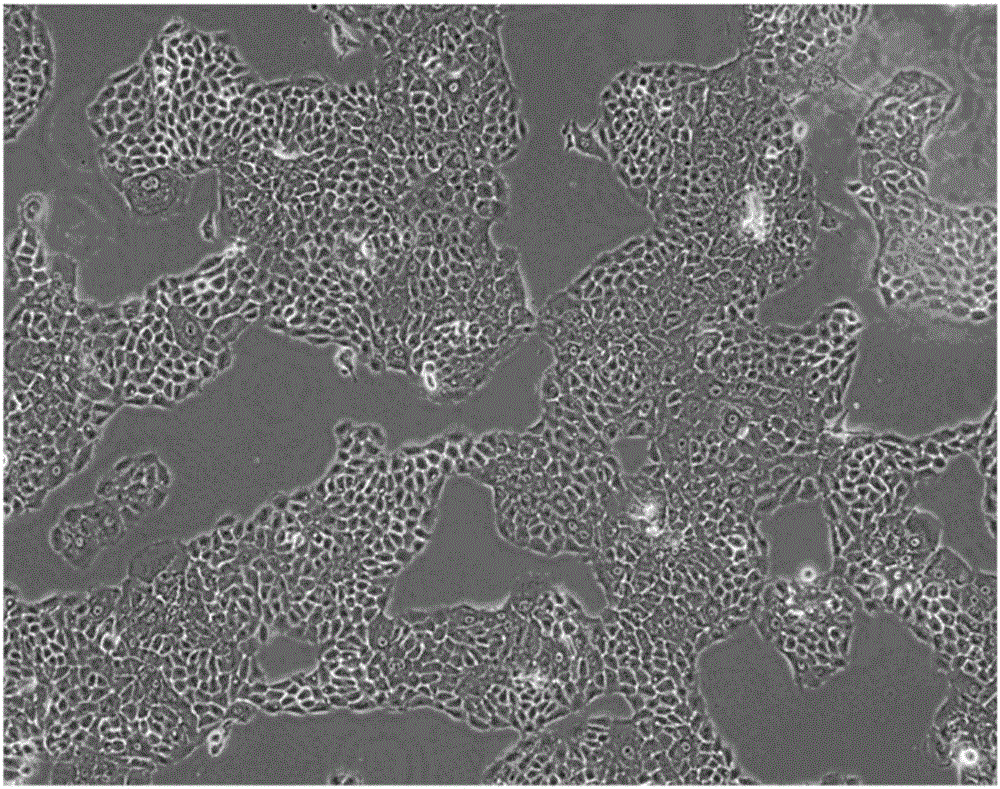 Human normal vaginal epithelial cells and application thereof