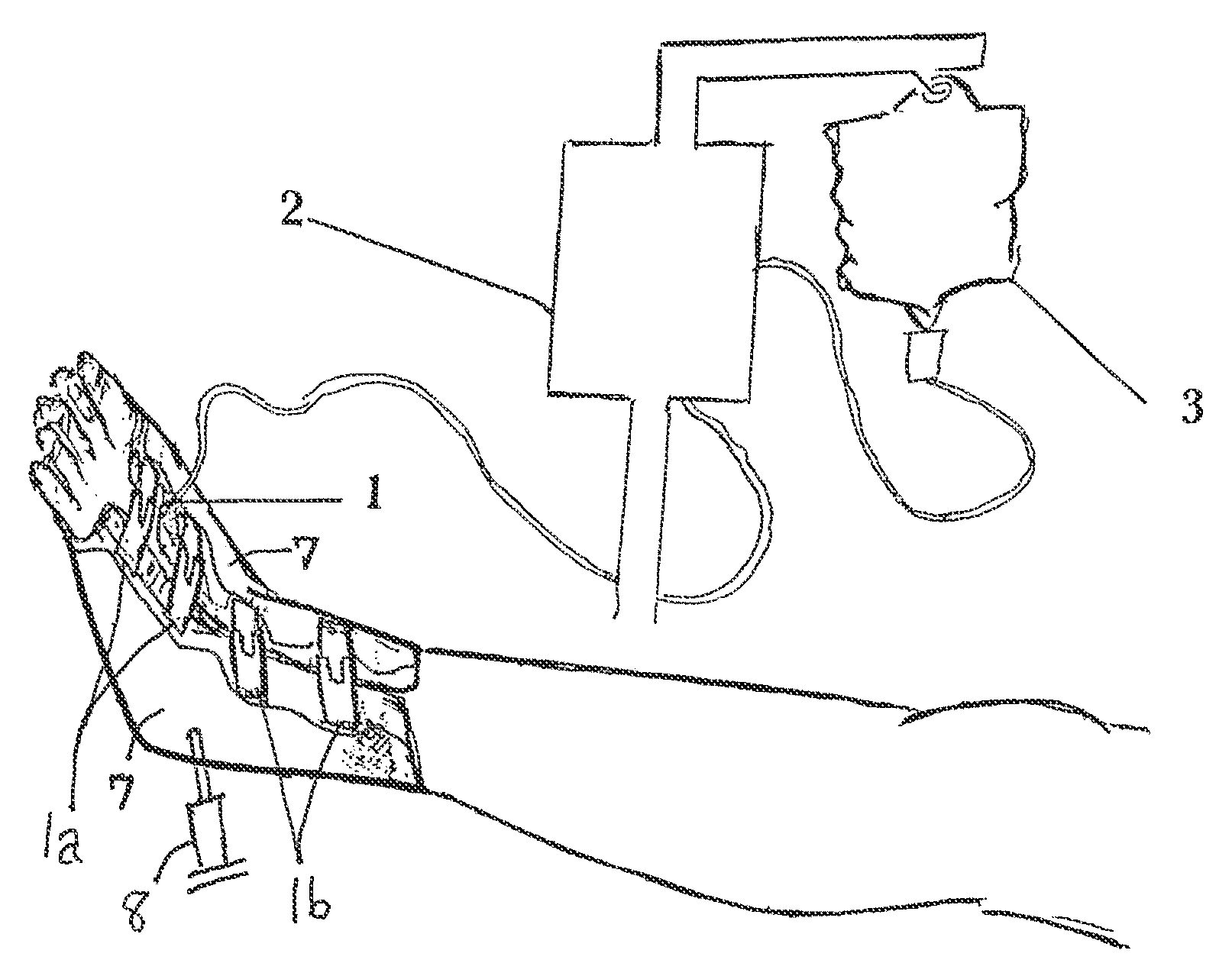 Device and method for prevention and treatment of deep venous thrombosis