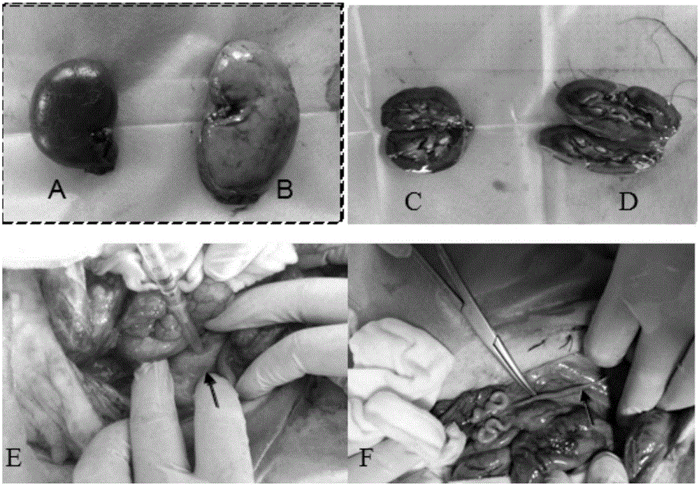 A Combination Tool for Establishing a Porcine Model of Recanalization of Unilateral Ureteral Obstruction