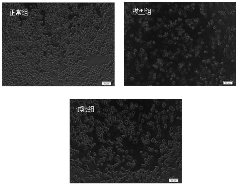 A method for inhibiting photodegradation of ergothioneine and its application