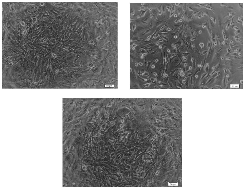 A method for inhibiting photodegradation of ergothioneine and its application