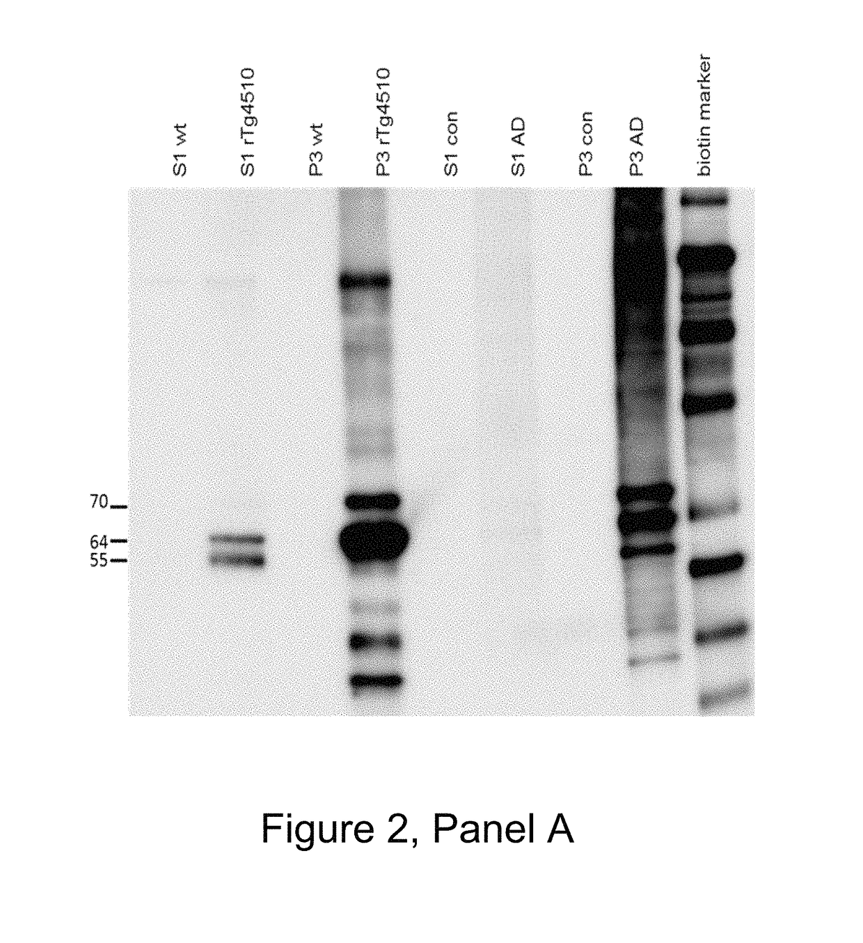 Antibodies specific for hyperphosphorylated tau and methods of use thereof