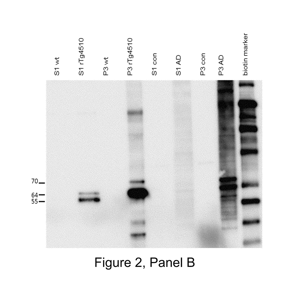 Antibodies specific for hyperphosphorylated tau and methods of use thereof