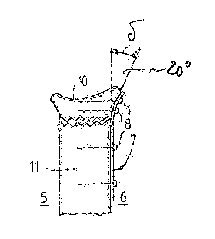 Method of treating a distal radius fracture