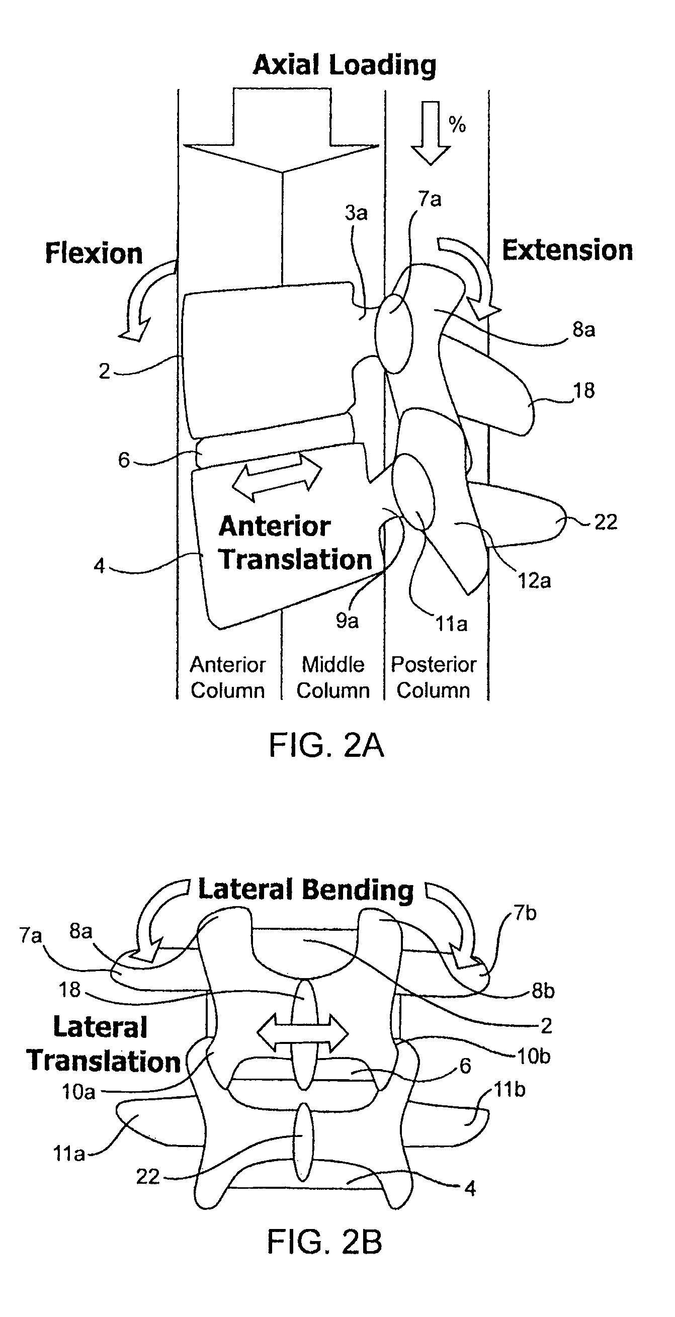 Systems and methods for stabilizing the motion or adjusting the position of the spine