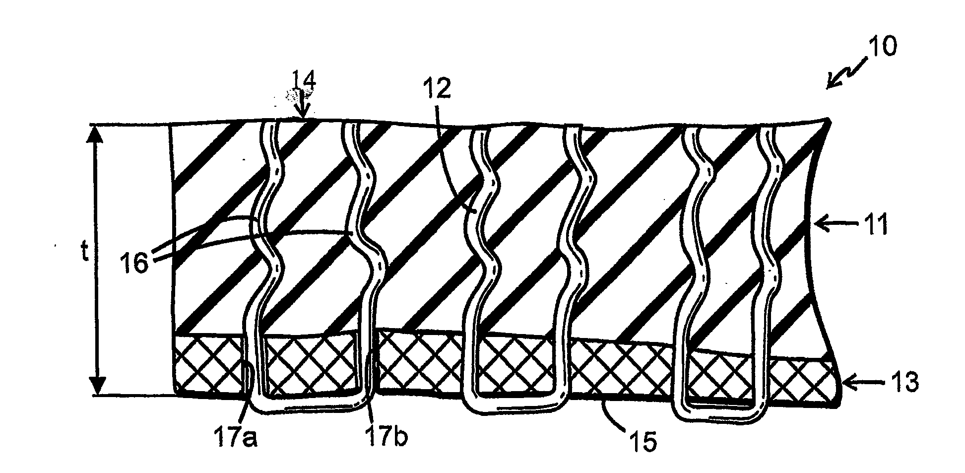 Elastomer structure