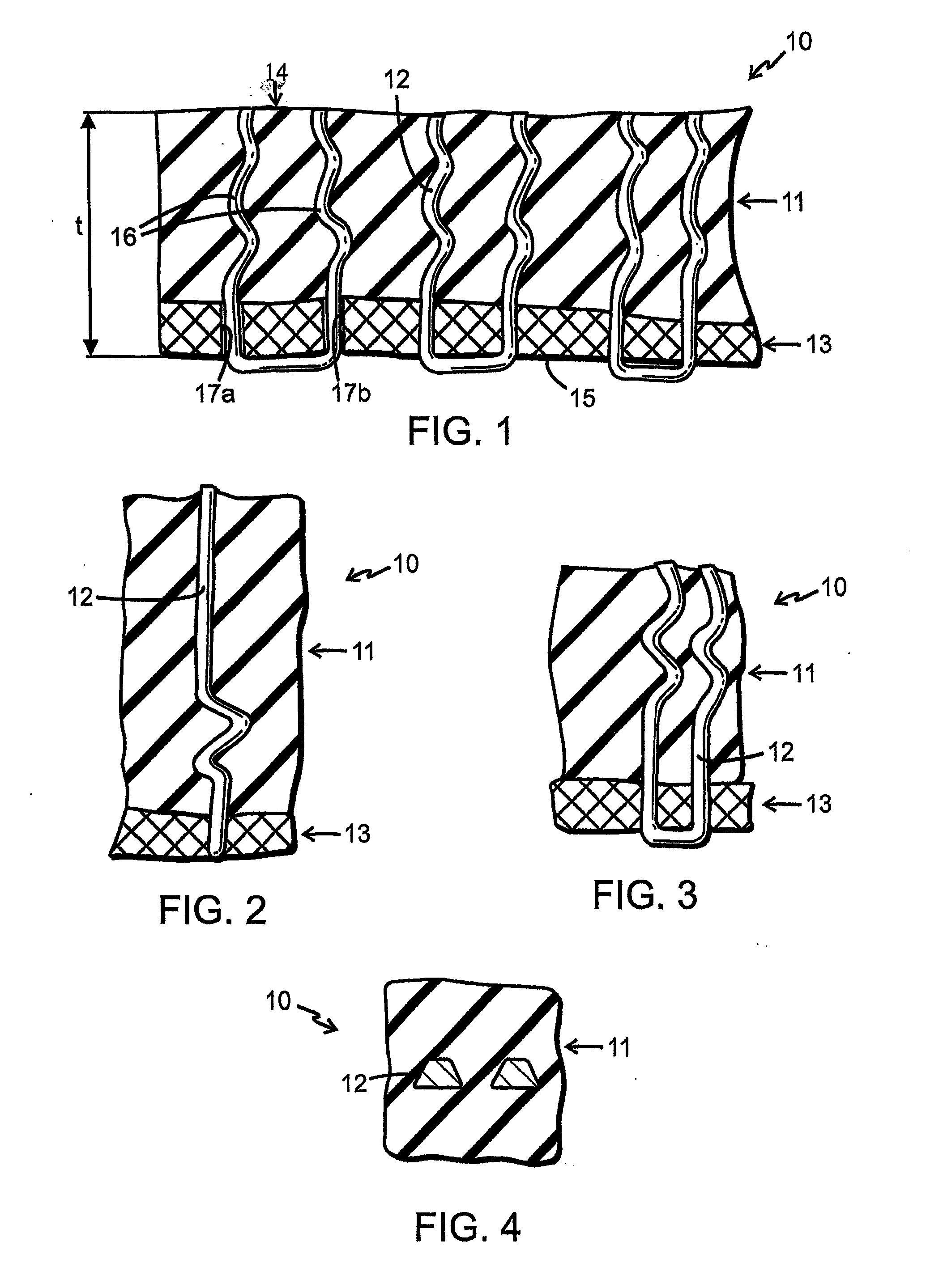 Elastomer structure