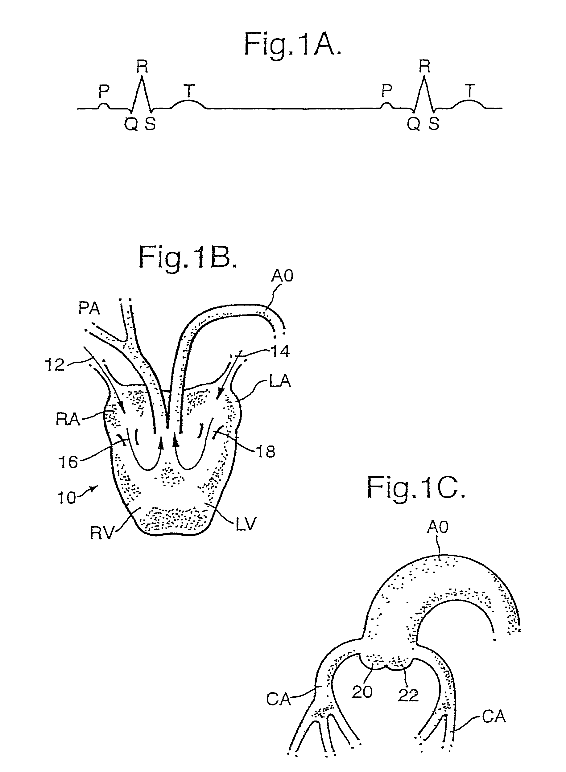 Electrotherapy apparatus and method of treating a person or a mammal using such electrotherapy apparatus