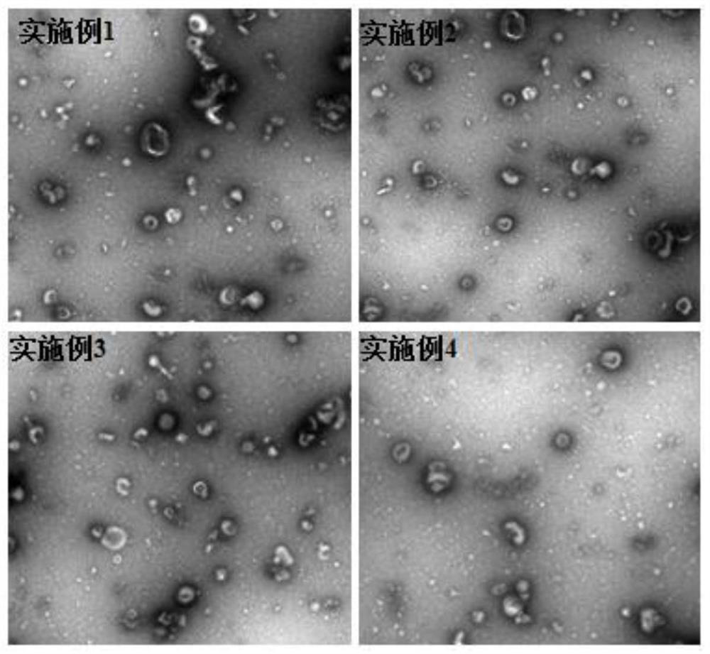A preparation method of injection for treating androgenetic alopecia using dermal papilla cell exosomes