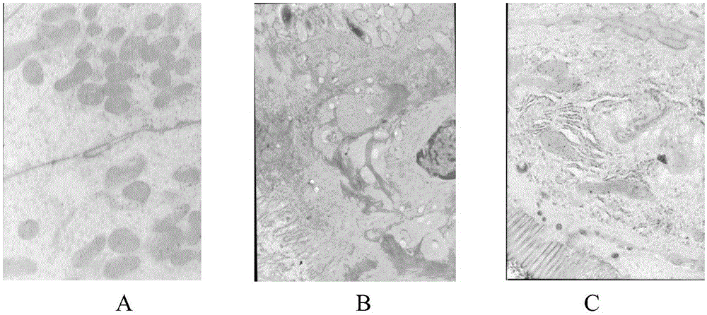 Application of glycyrrhetinic acid in preparation of anti-radiation product