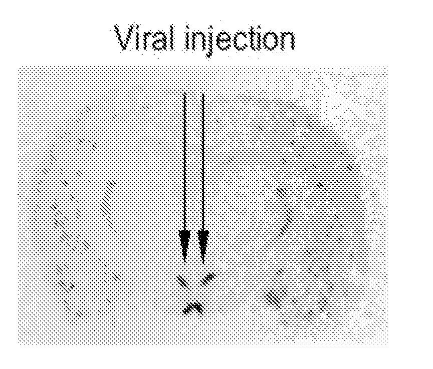 Compositions and methods for treating obesity