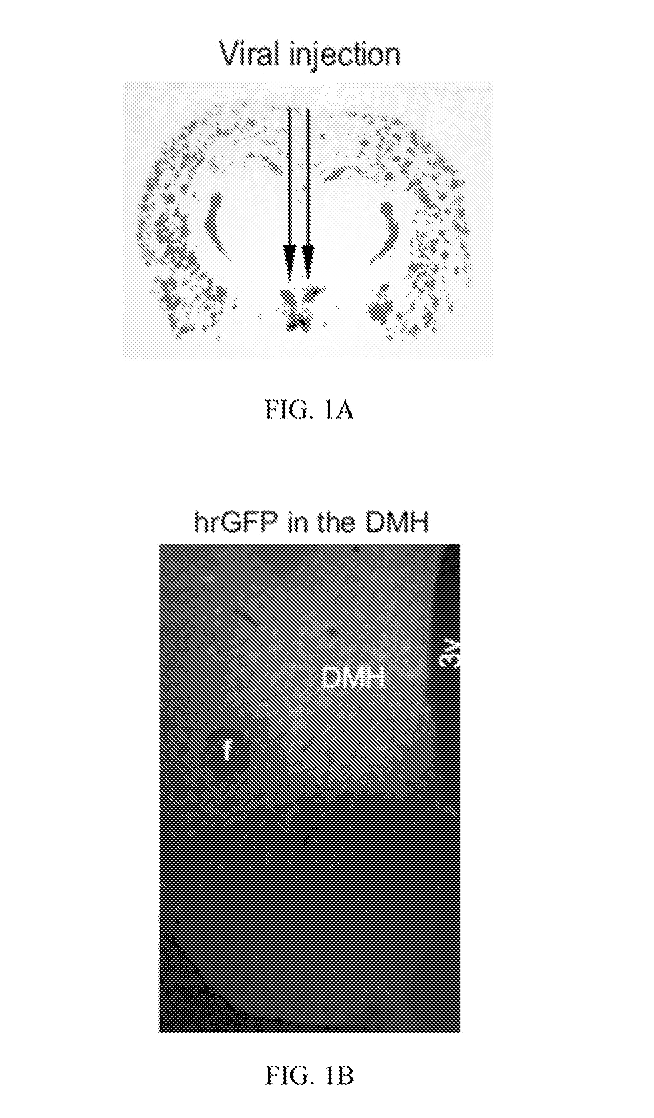 Compositions and methods for treating obesity