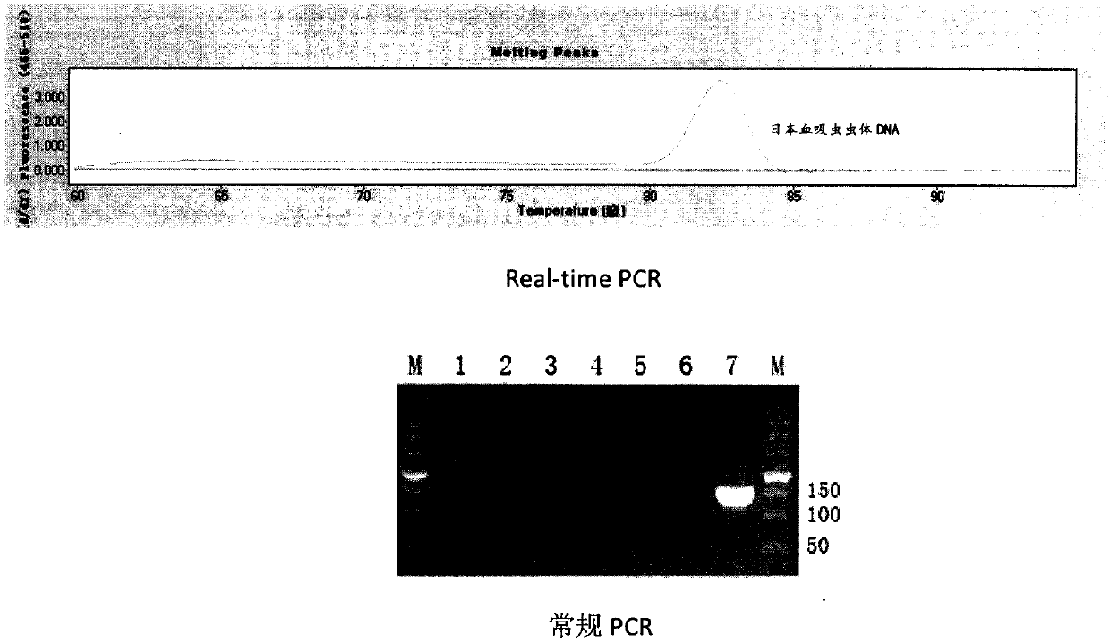 Nucleic acid diagnosis kit for detecting schistosoma japonicum and detection method with nucleic acid diagnosis kit