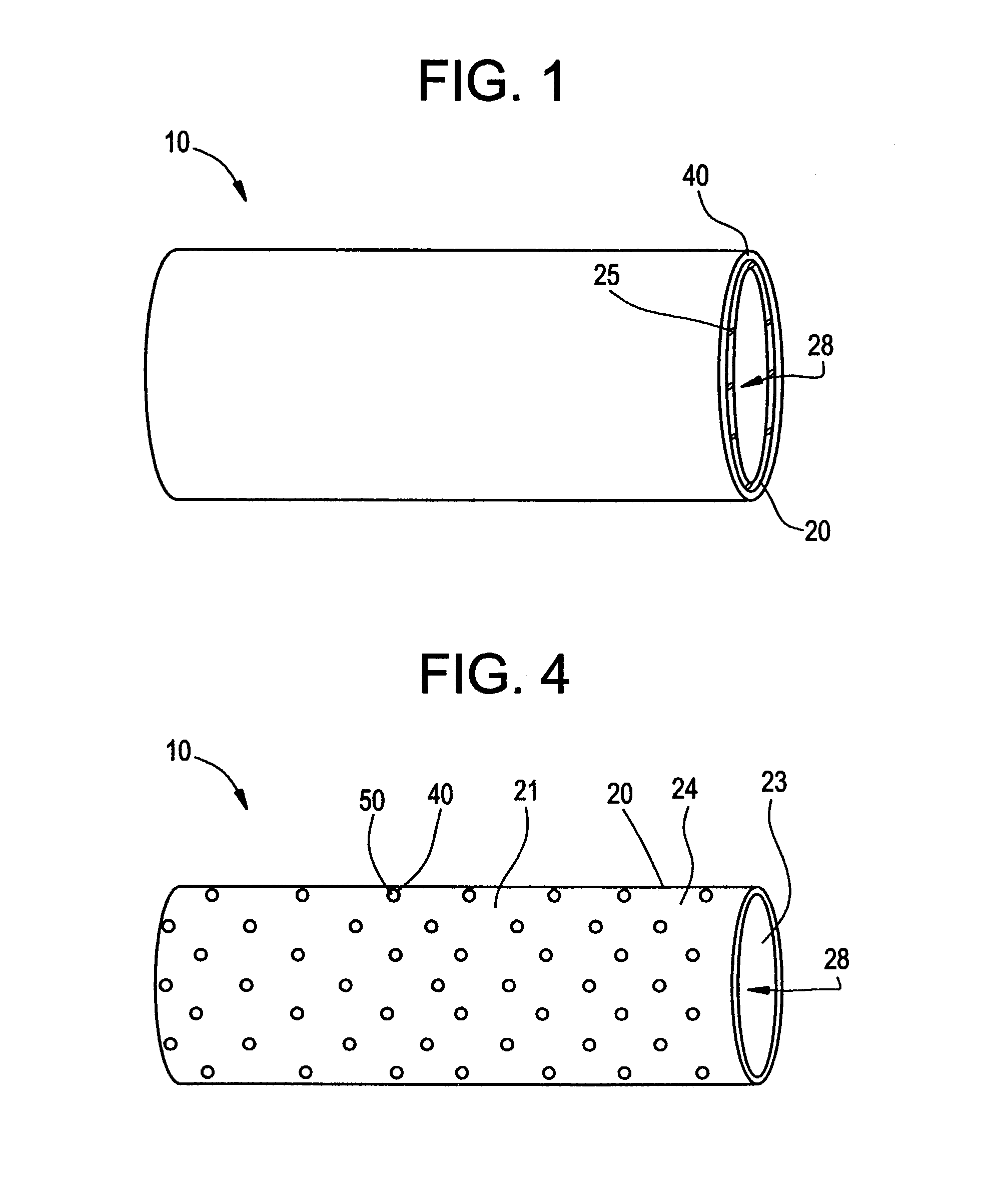 Intraluminal lining