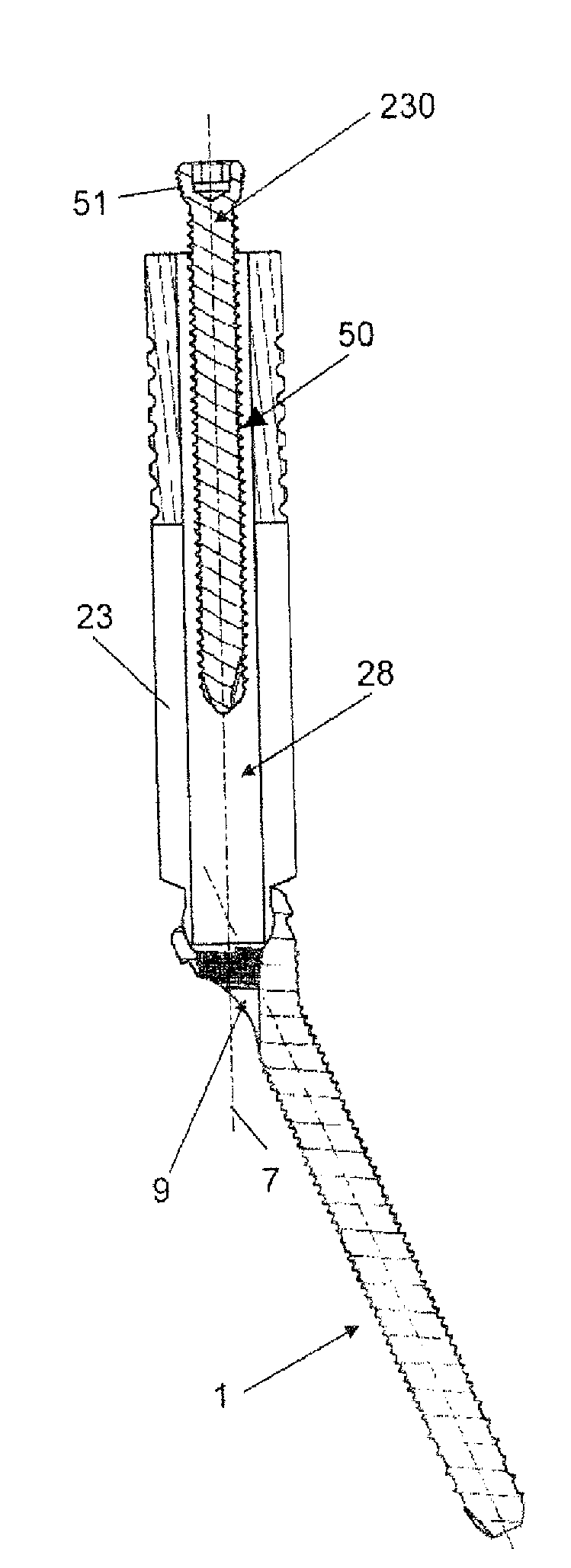 Bone Screw Assembly and Instruments for Implantation of the Same