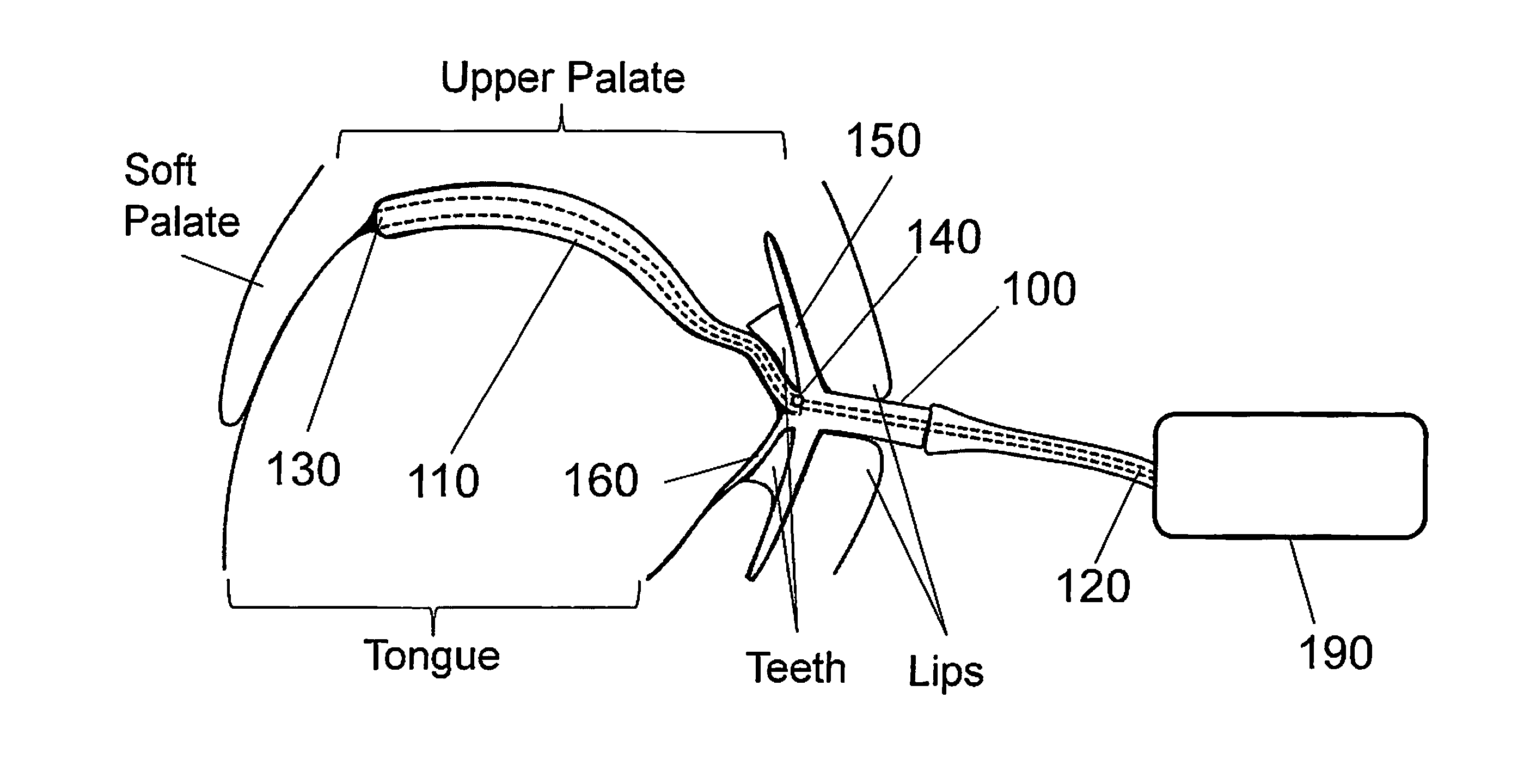 Oral Device to Eliminate Air Space in Oral Cavity