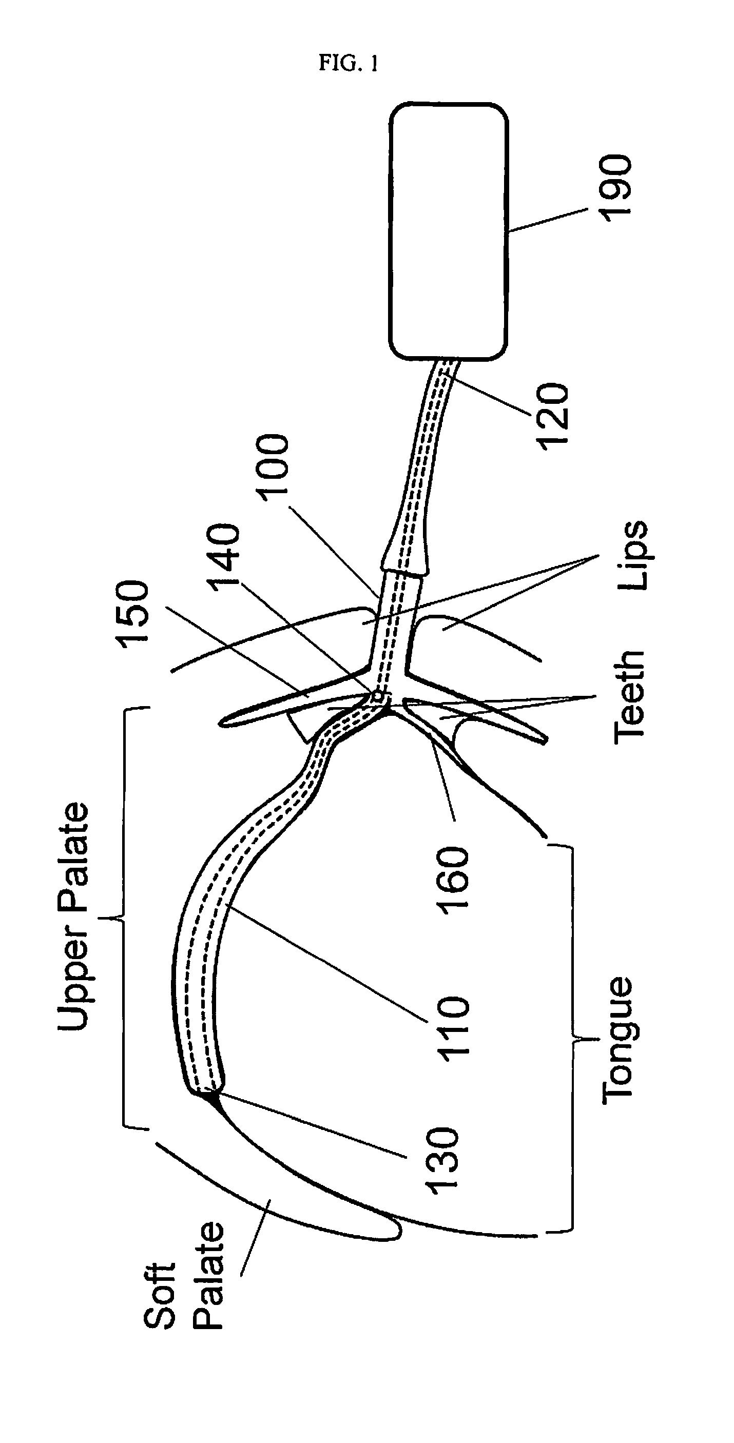 Oral Device to Eliminate Air Space in Oral Cavity