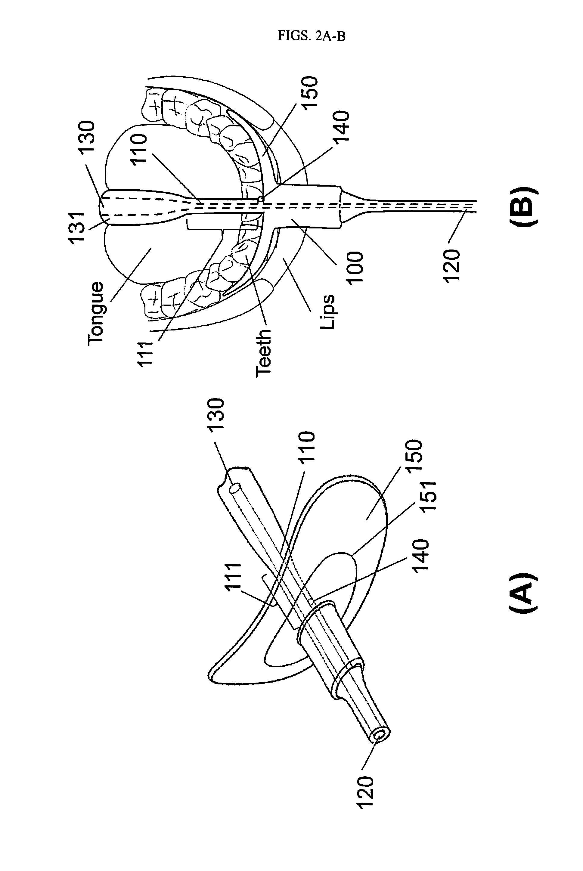 Oral Device to Eliminate Air Space in Oral Cavity