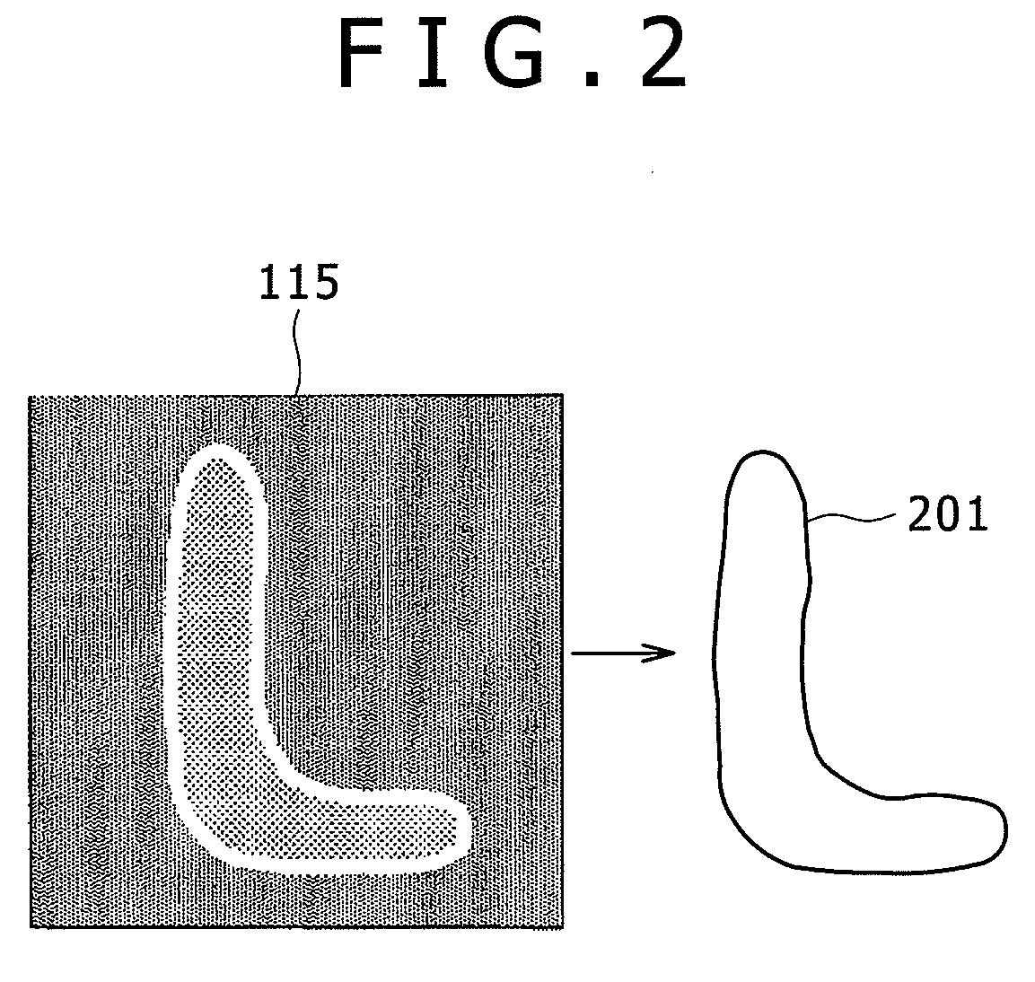 Method and apparatus for inspecting defect of pattern formed on semiconductor device